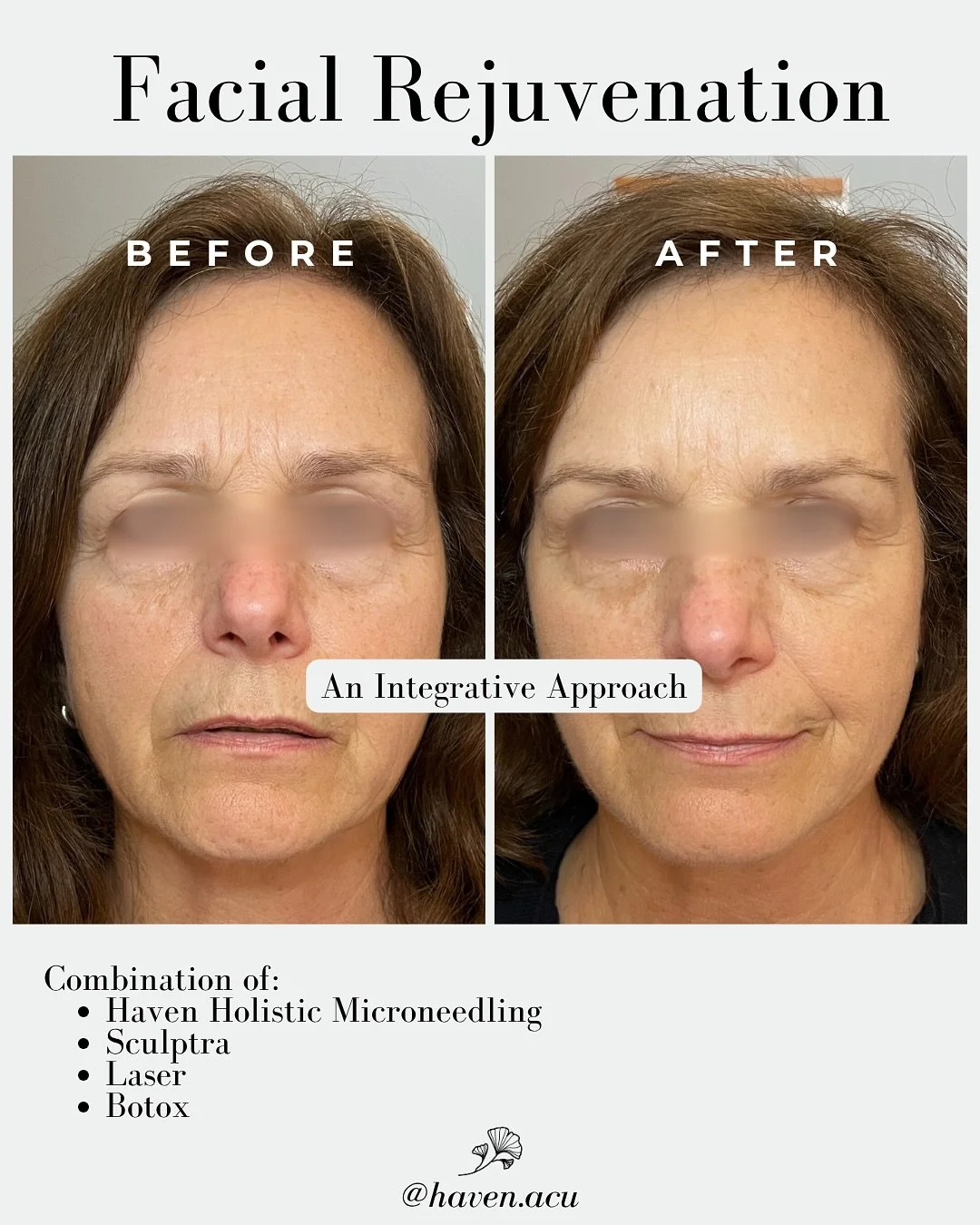 It doesn&rsquo;t have to be all or nothing. ✨

In my clinic, I see both sides -&nbsp; those who want to stay completely &ldquo;natural,&rdquo; and those who love their dermatologist or medspa visits for more invasive procedures. The truth? You don&rs