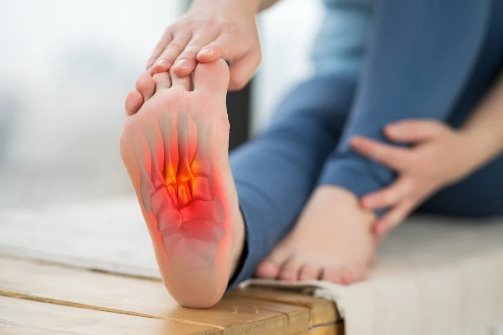 Dry Needling for Plantar Fasciitis A Comprehensive Guide — PT on Tap