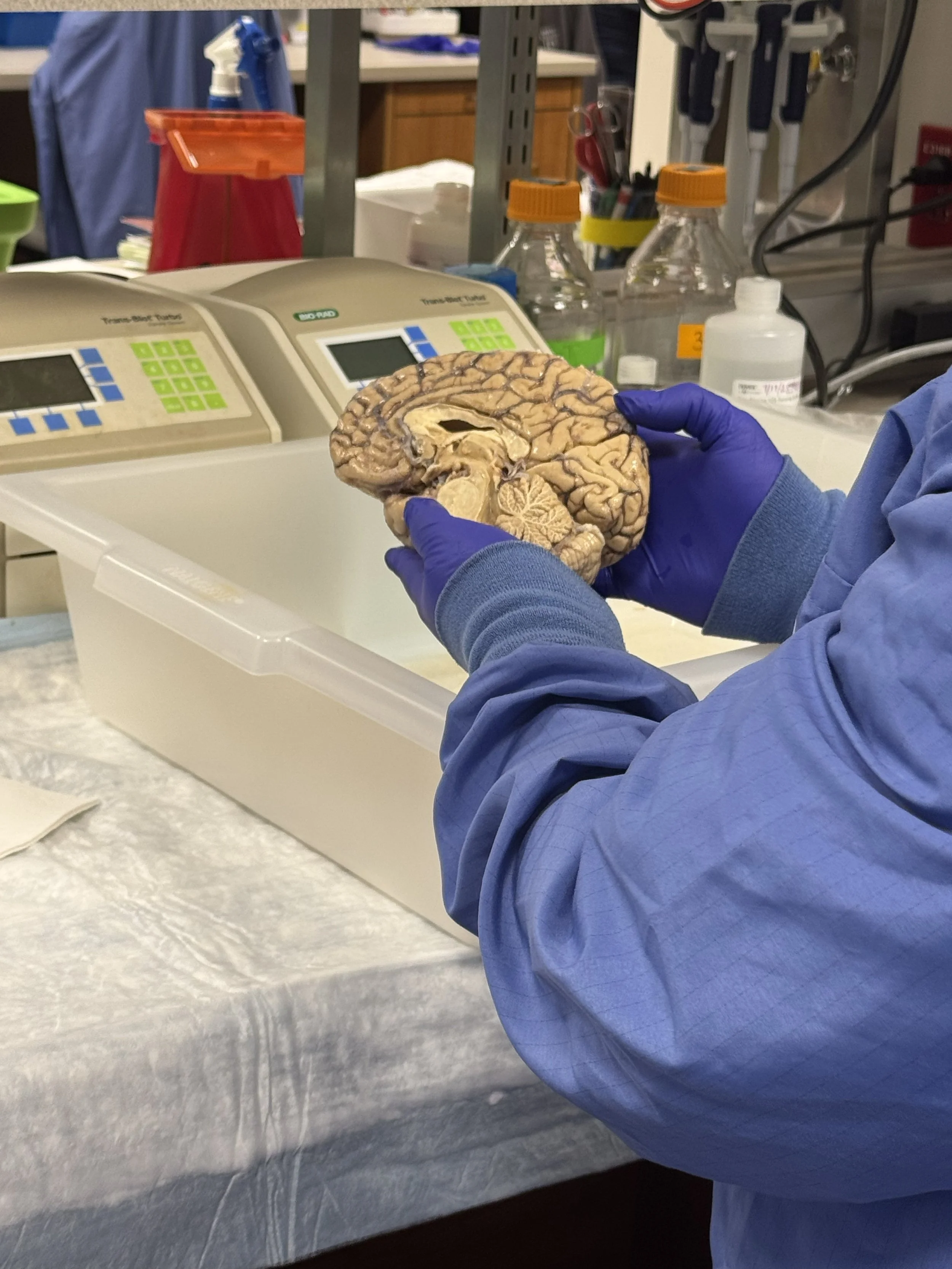 Dr. Jimmie Williamson Supports Rotary-Led Efforts to Advance Alzheimer’s and Dementia Research
