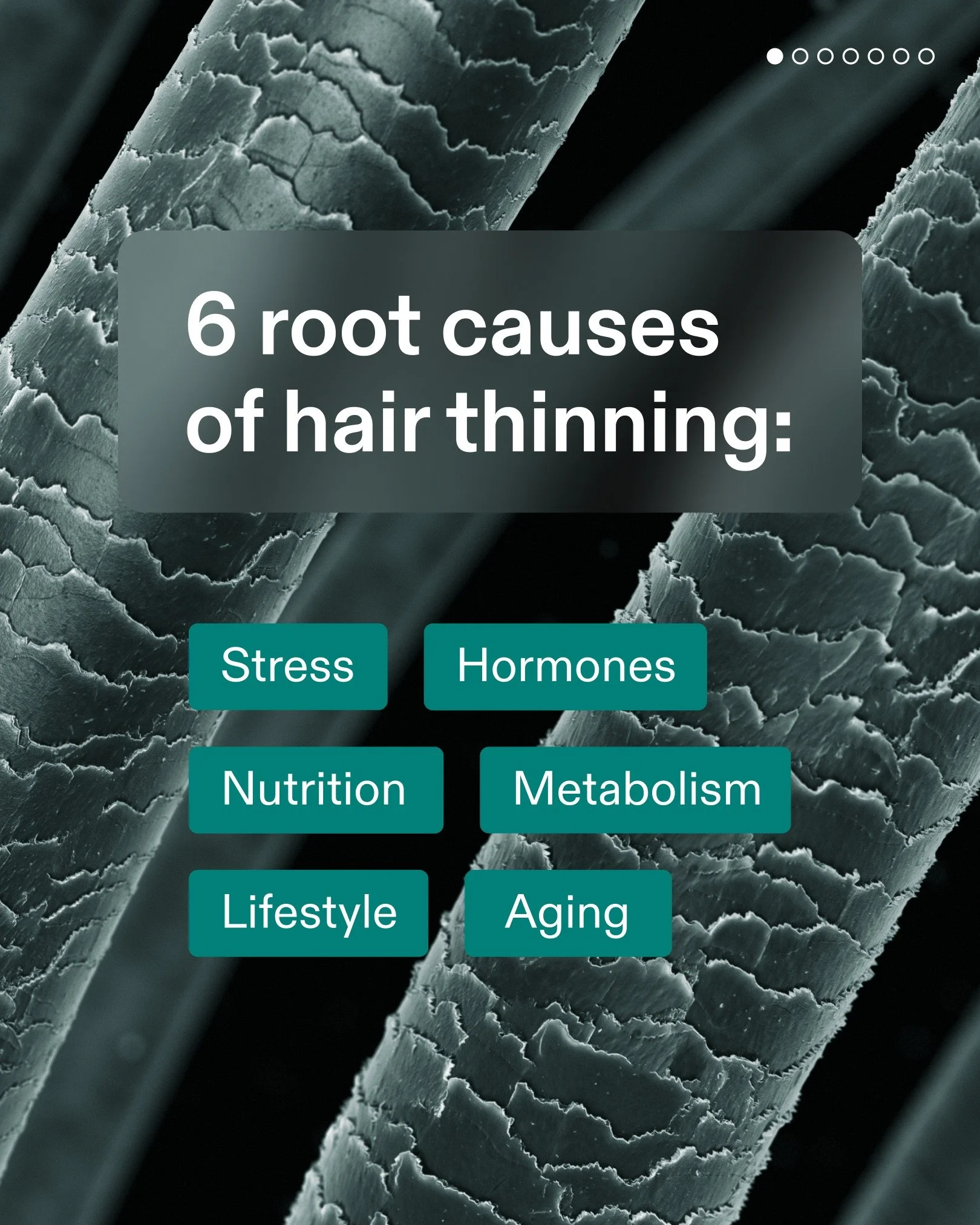 There are various root causes of hair thinning, each linked to your overall health. That's why Nutrafol takes a whole-body approach to hair growth- with formulas that address these key factors from within. 🌿

Start the New Year with strong, healthy 