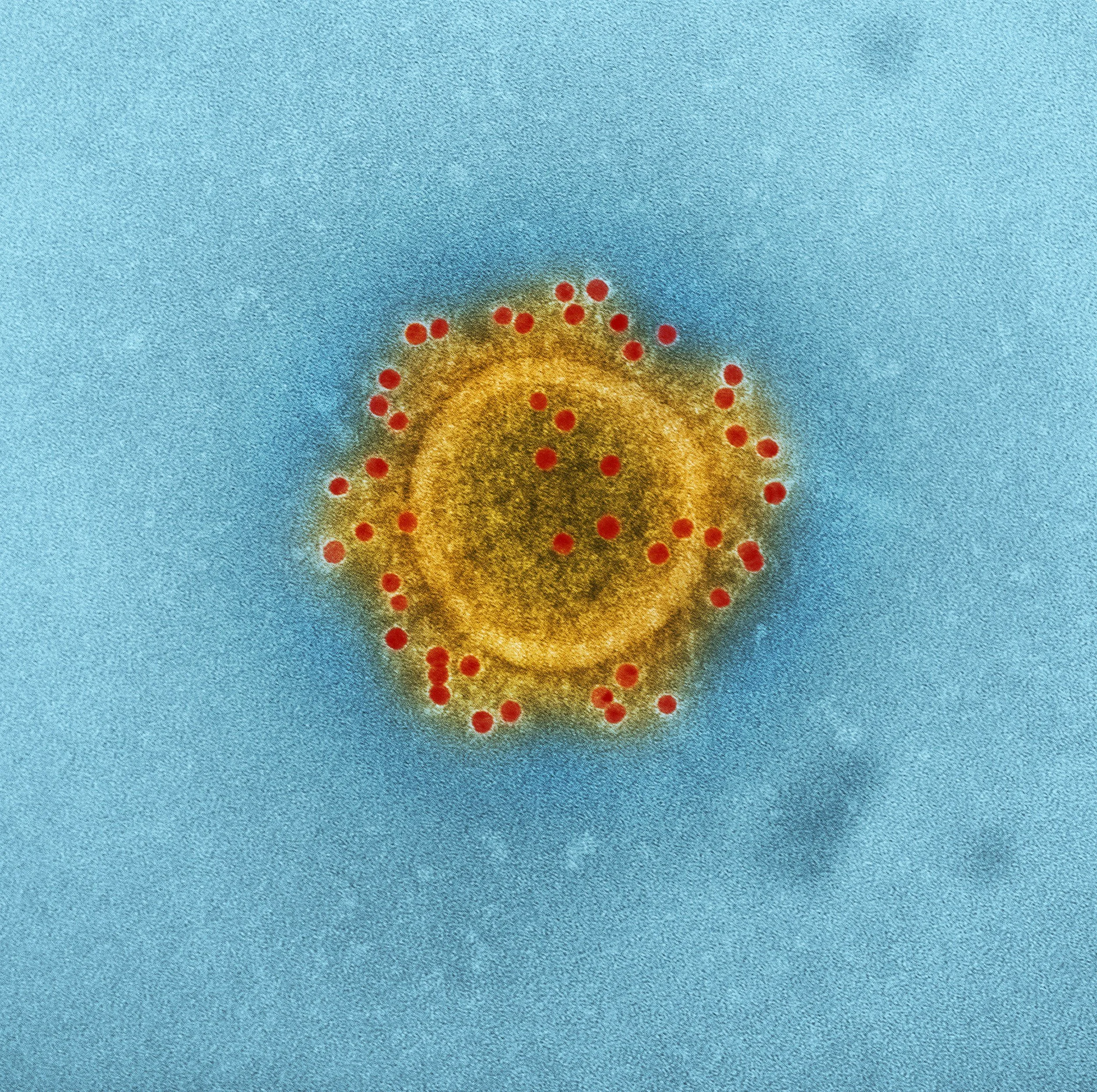 Mast Cell Dysfunction
