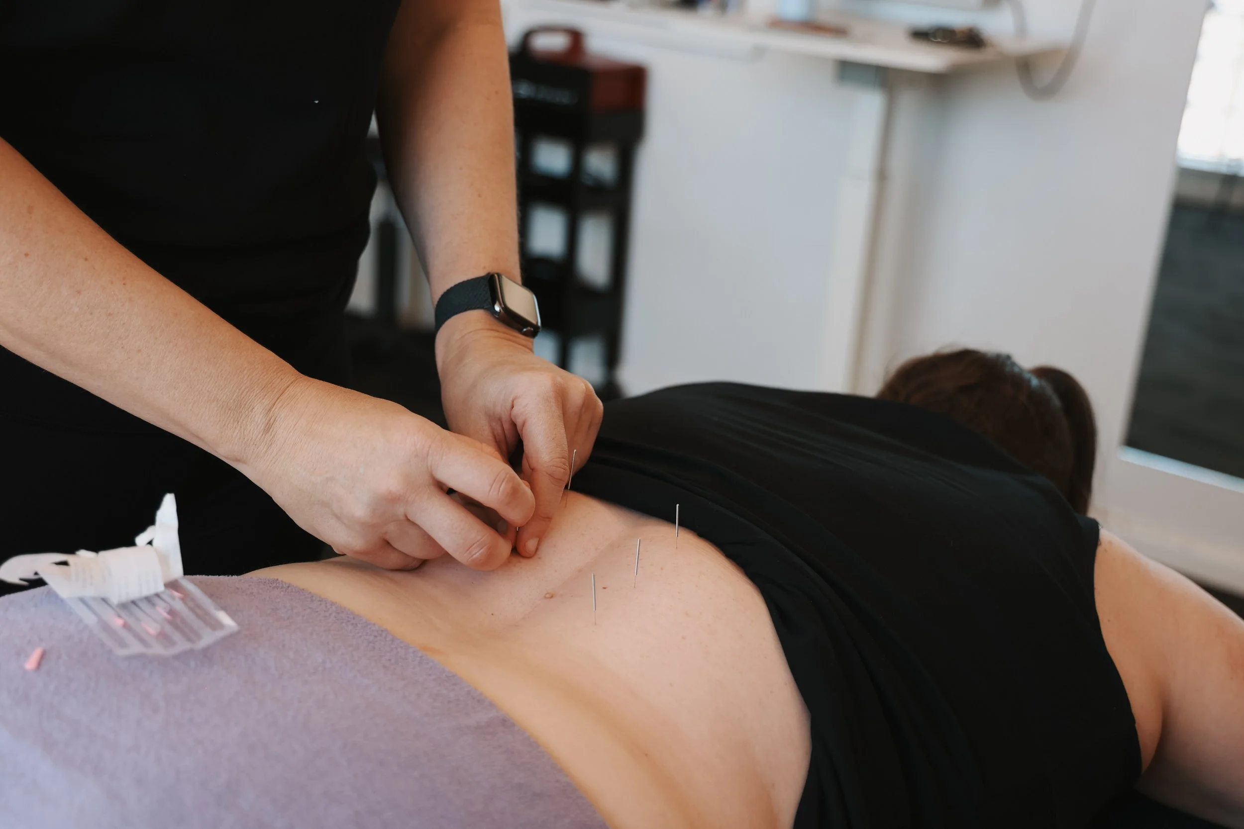 Lauren - Acupuncture 1.jpg