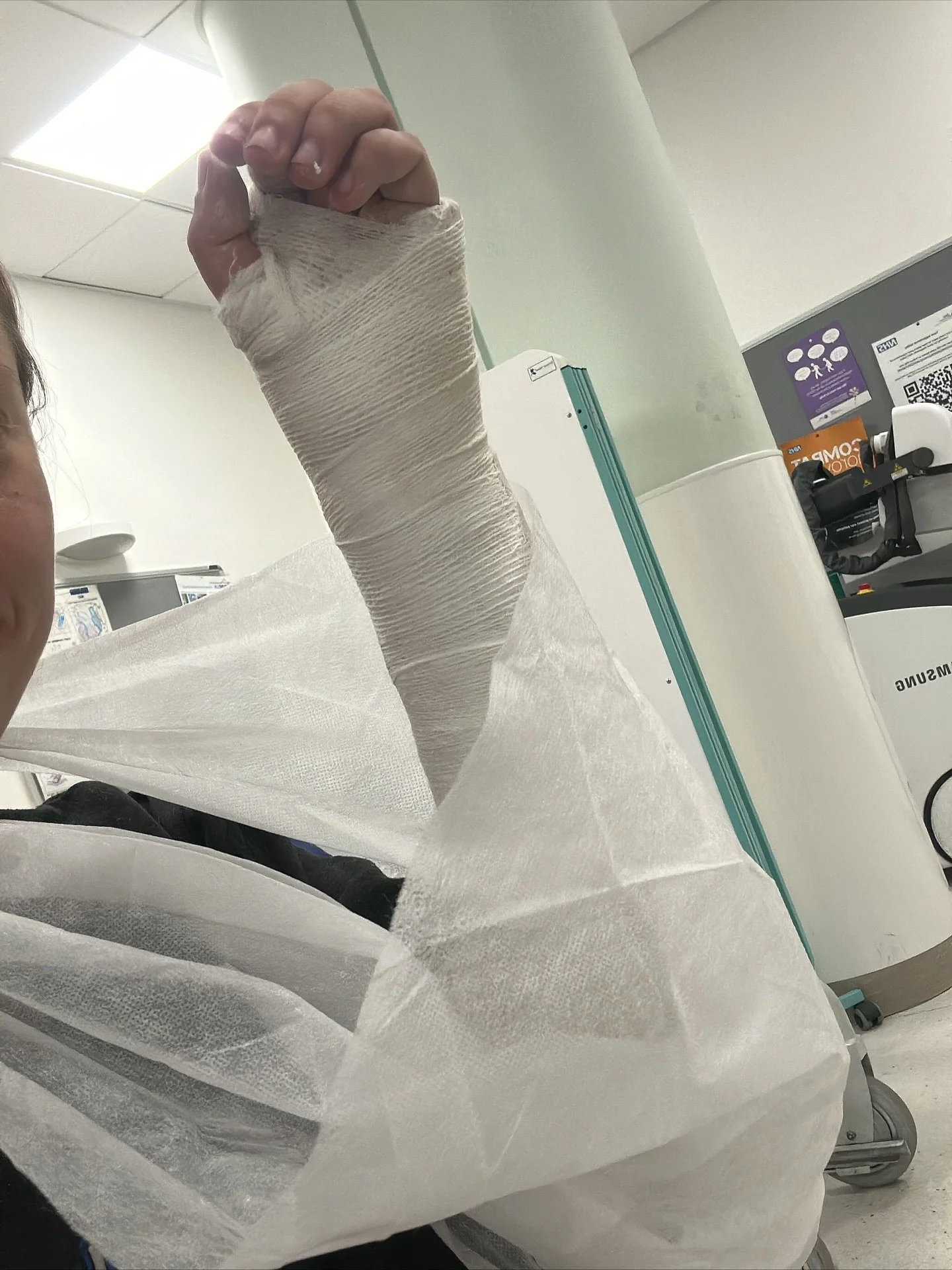 I’ve already popped this on Facebook but just incase some of you aren’t on there I’ll pop it here too!
So unfortunately I’ve broken my arm.. this does put a bit of a spanner in the works in terms of walking dogs 🫣
I am still