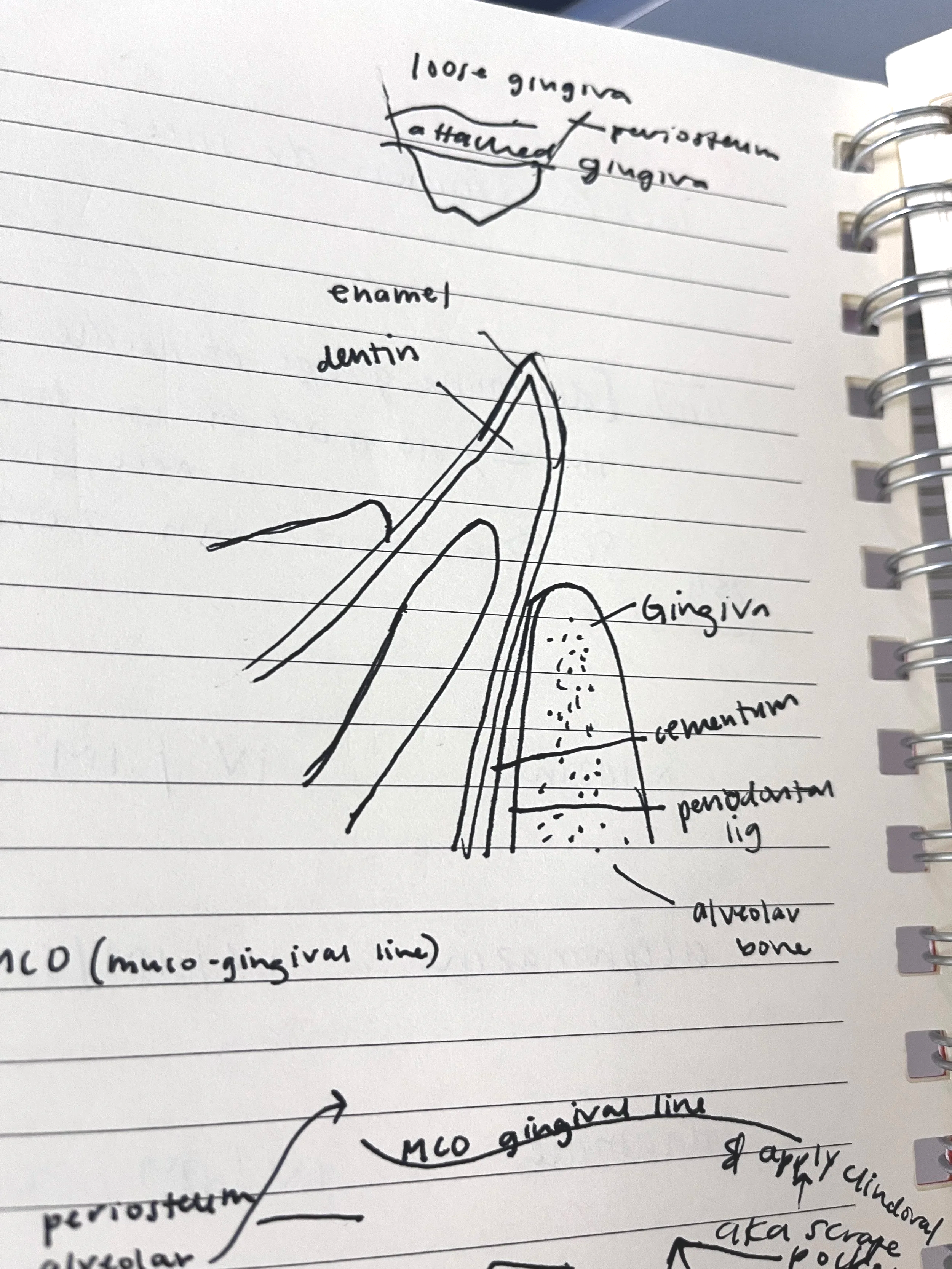 A notebook page with hand drawn diagram of a tooth