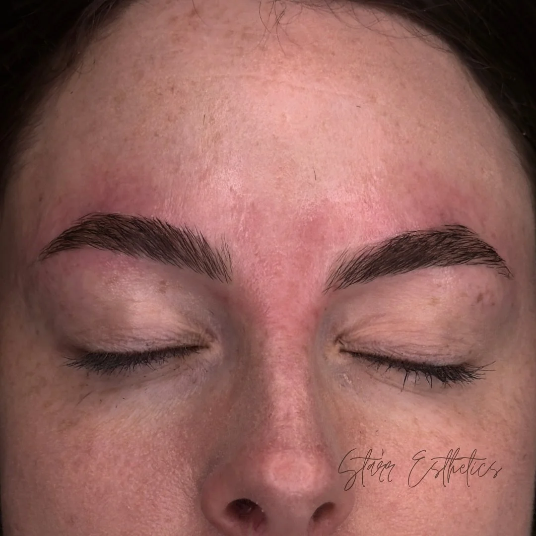 Deja vu? Yes. It means you need to come see me. Schedule your appointment asap 😉