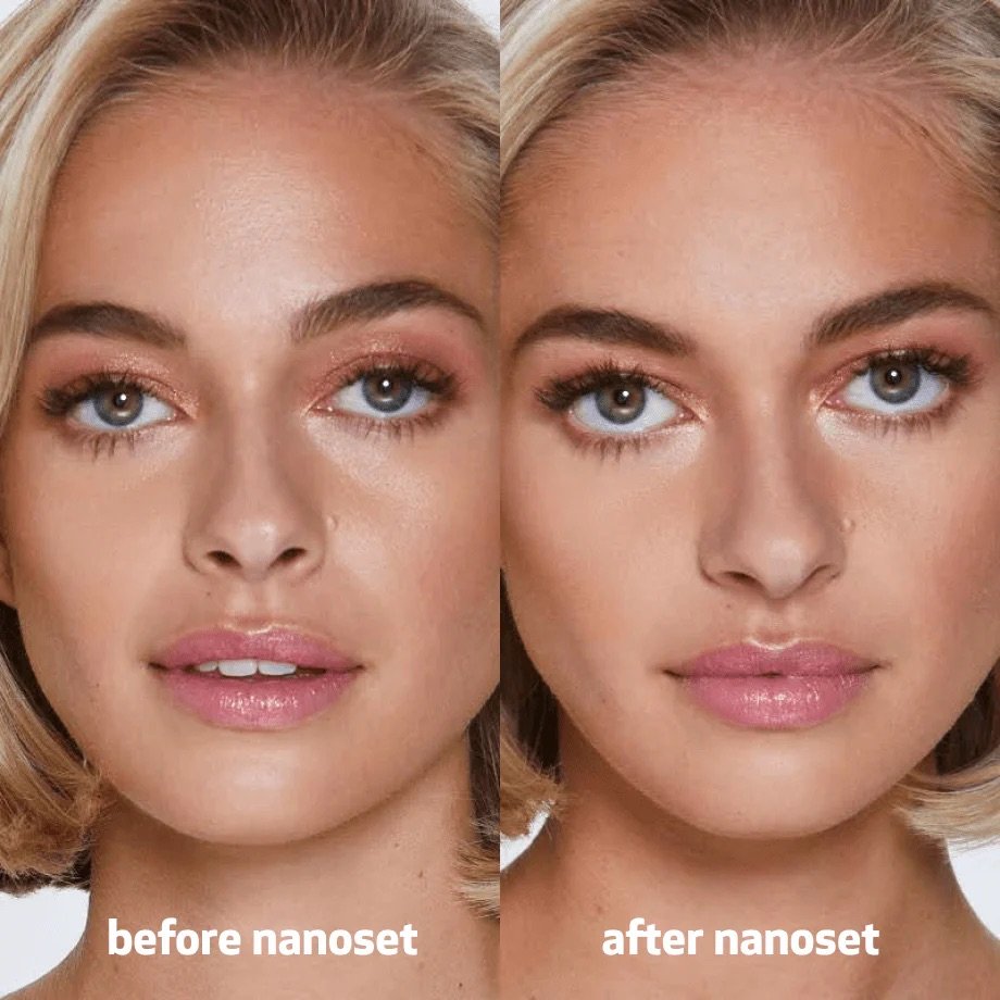 nanoset2.jpeg