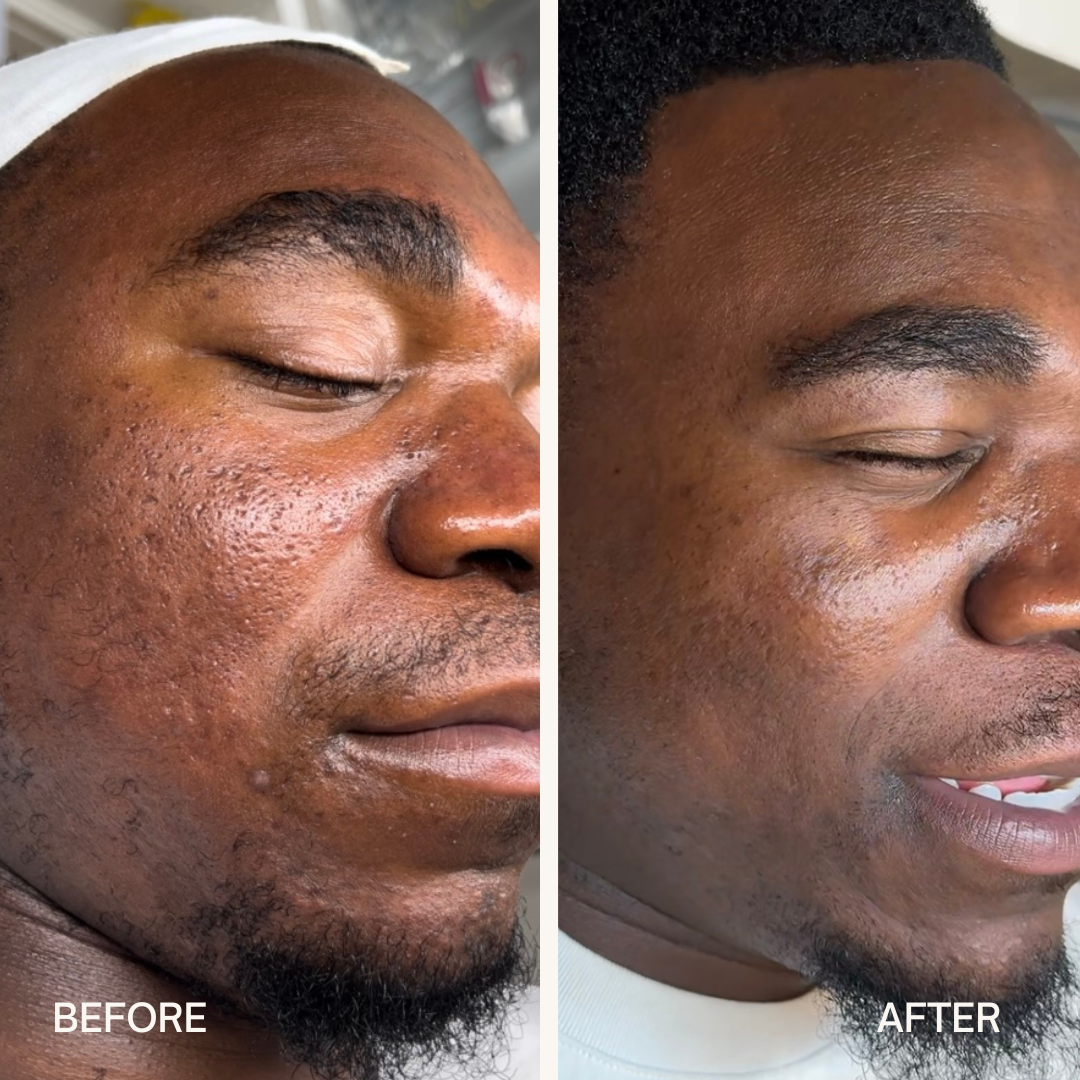 Why Men’s Facials Matter