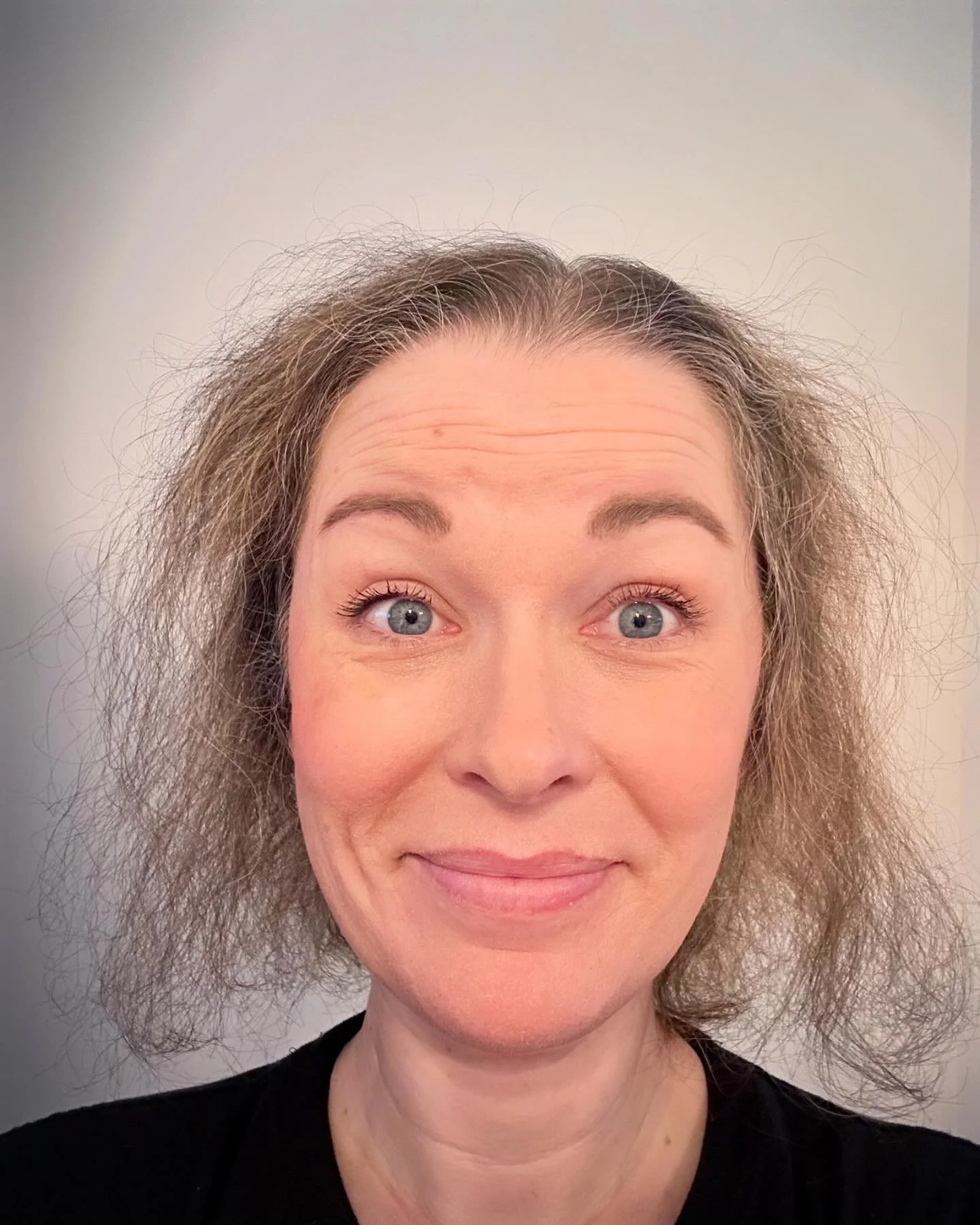 I spent 25 years ashamed of my alopecia and hid it. Now I'm proud to show up as I am, hair loss and all.