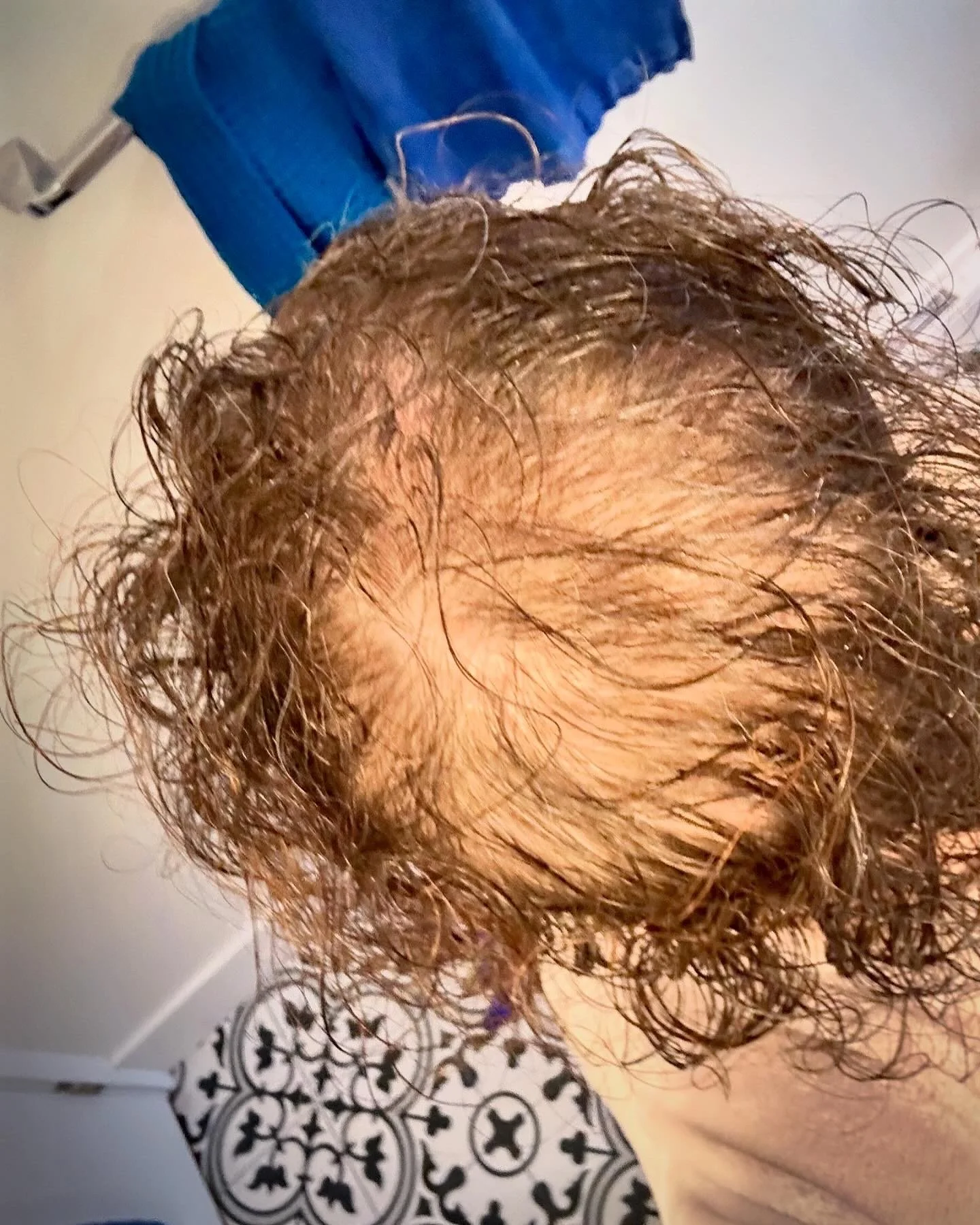 My goal is to help other women like me who are struggling with hair loss.