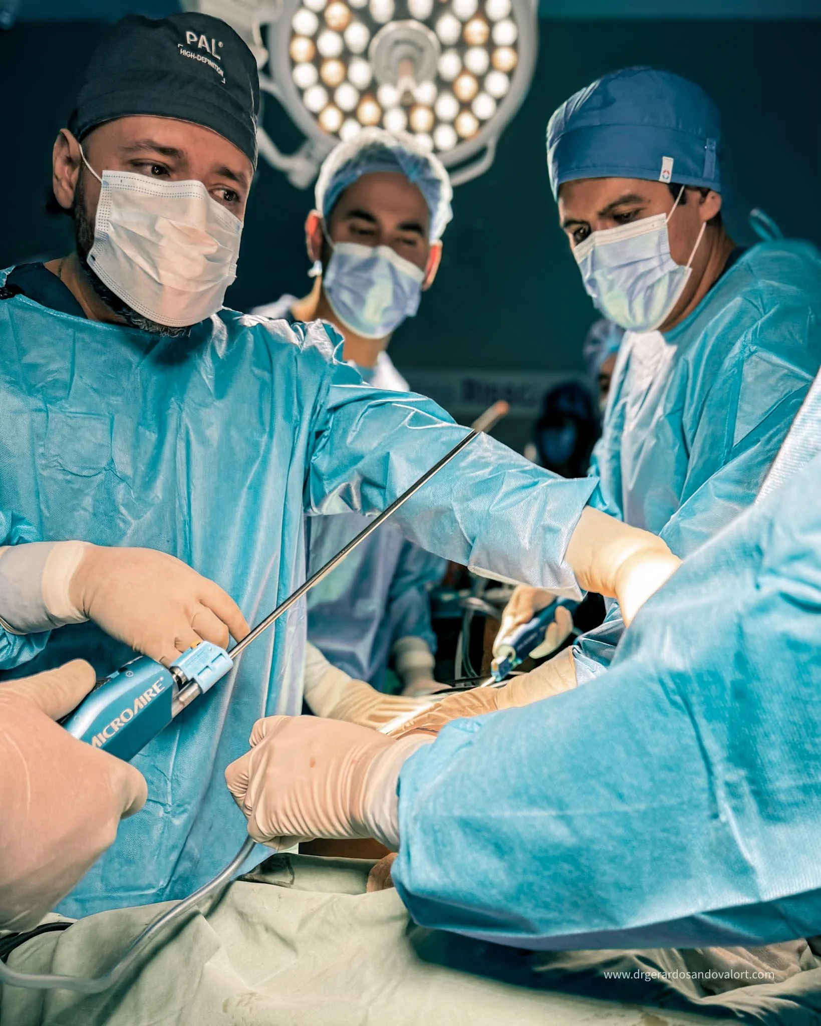 El Dr. Luis Gerardo Sandoval utilizando Renuvion®, VASER® y MicroAire® en una liposucción avanzada.