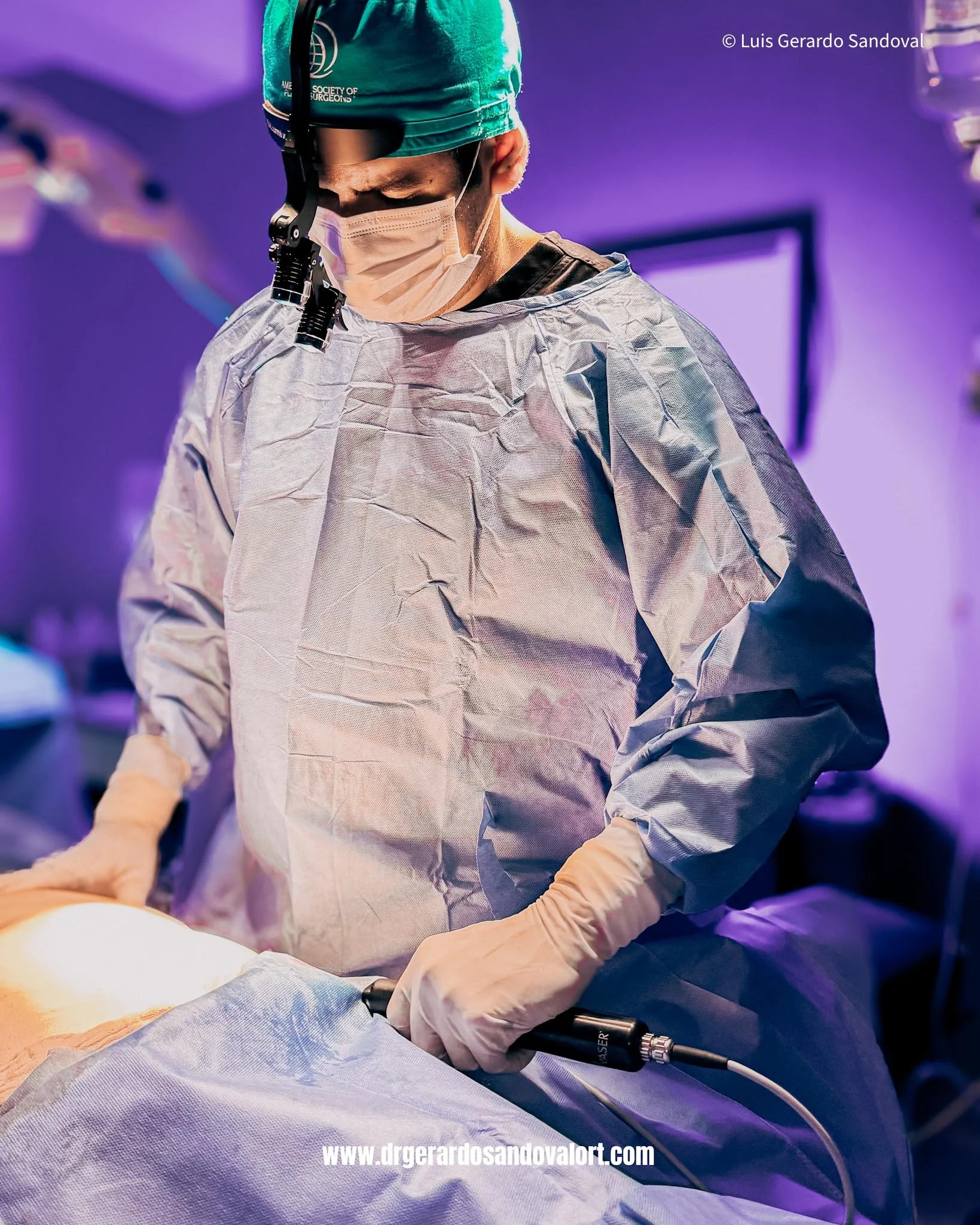 Dr. Luis Gerardo Sandoval realizando una lipoescultura 360 avanzada con ultrasonido en Lima, utilizando VASER® Ultrasonido de mas alta calidad