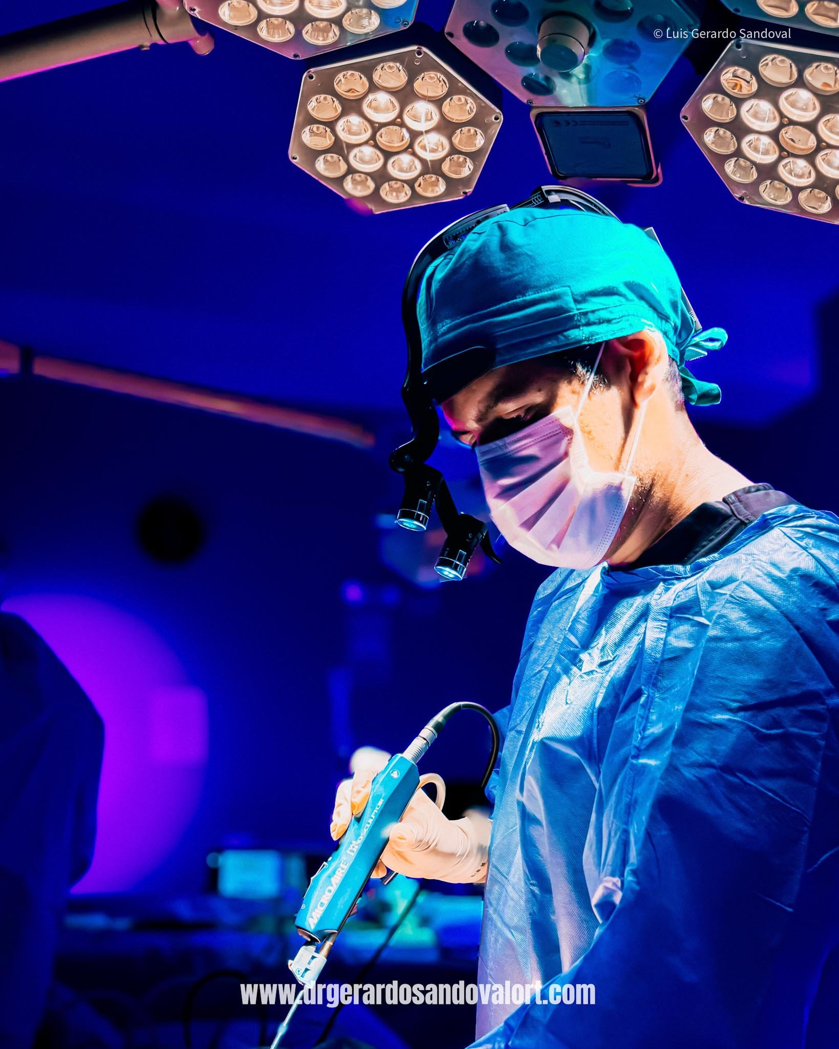 El Dr. Luis Gerardo Sandoval, cirujano plástico en Lima, utiliza la tecnología MicroAire® durante una liposucción asistida por vibraciones mecánicas (PAL) para asegurar una extracción de grasa precisa y menos traumática.