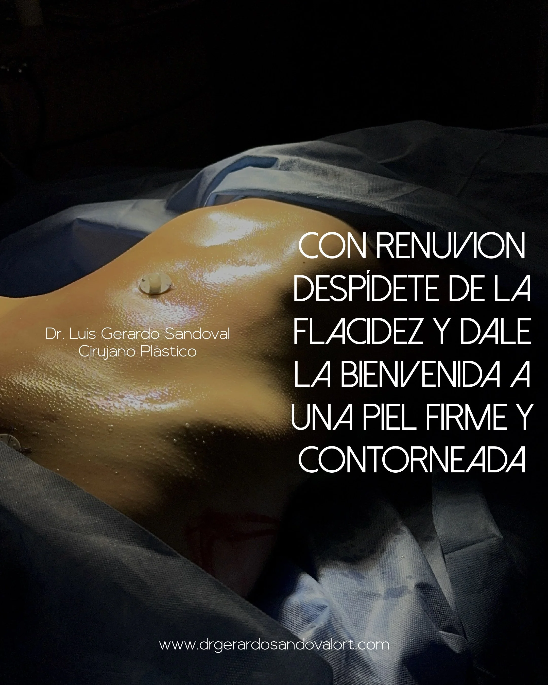 Tratamiento con Renuvion para eliminar flacidez y lograr piel firme en Lipoescultura y contorno corporal, Dr. Luis Gerardo Sandoval