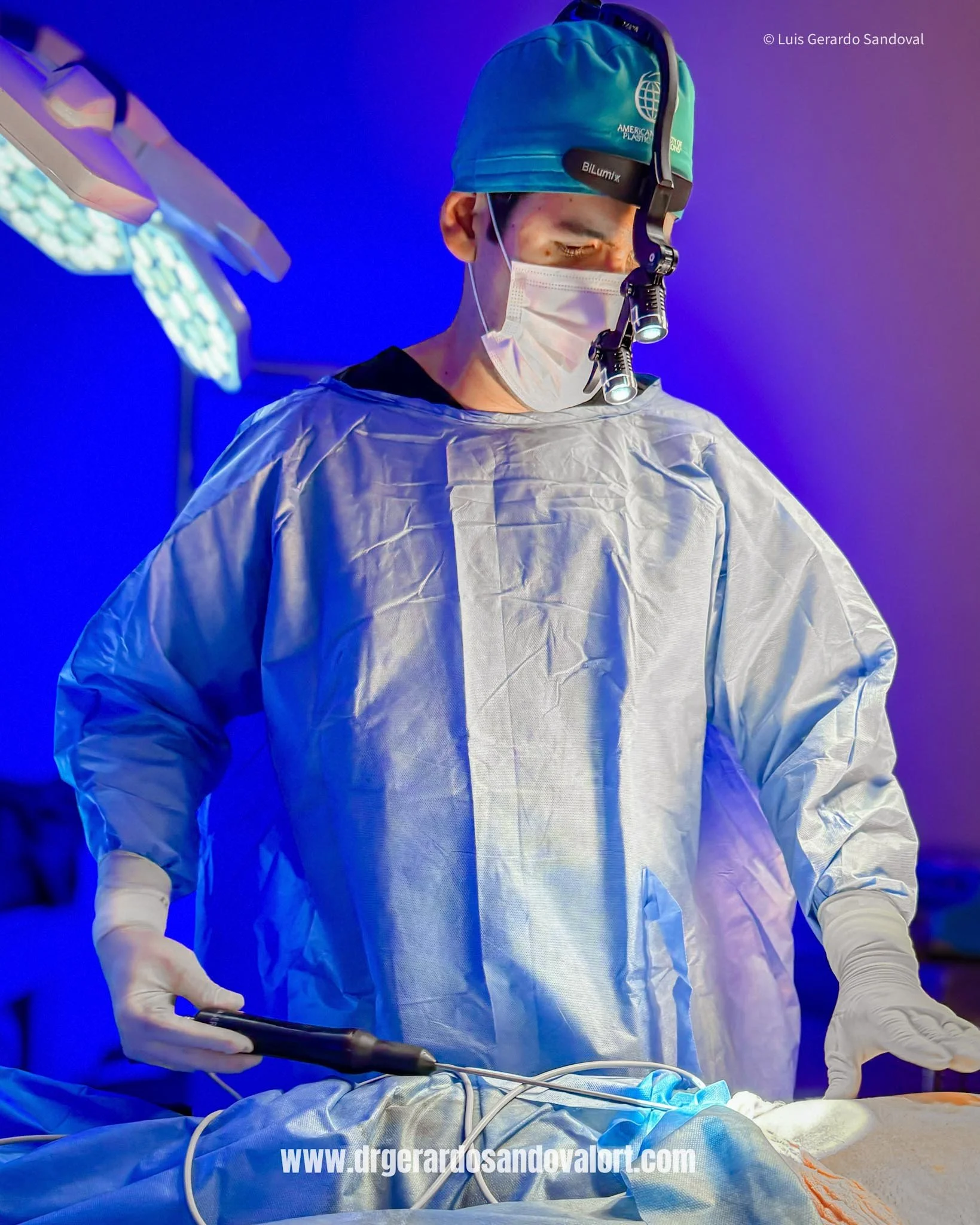 El Dr. Luis Gerardo Sandoval realiza Liposucción 360 en Lima utilizando VASER® para emulsificar grasa de forma precisa y garantizar resultados armónicos