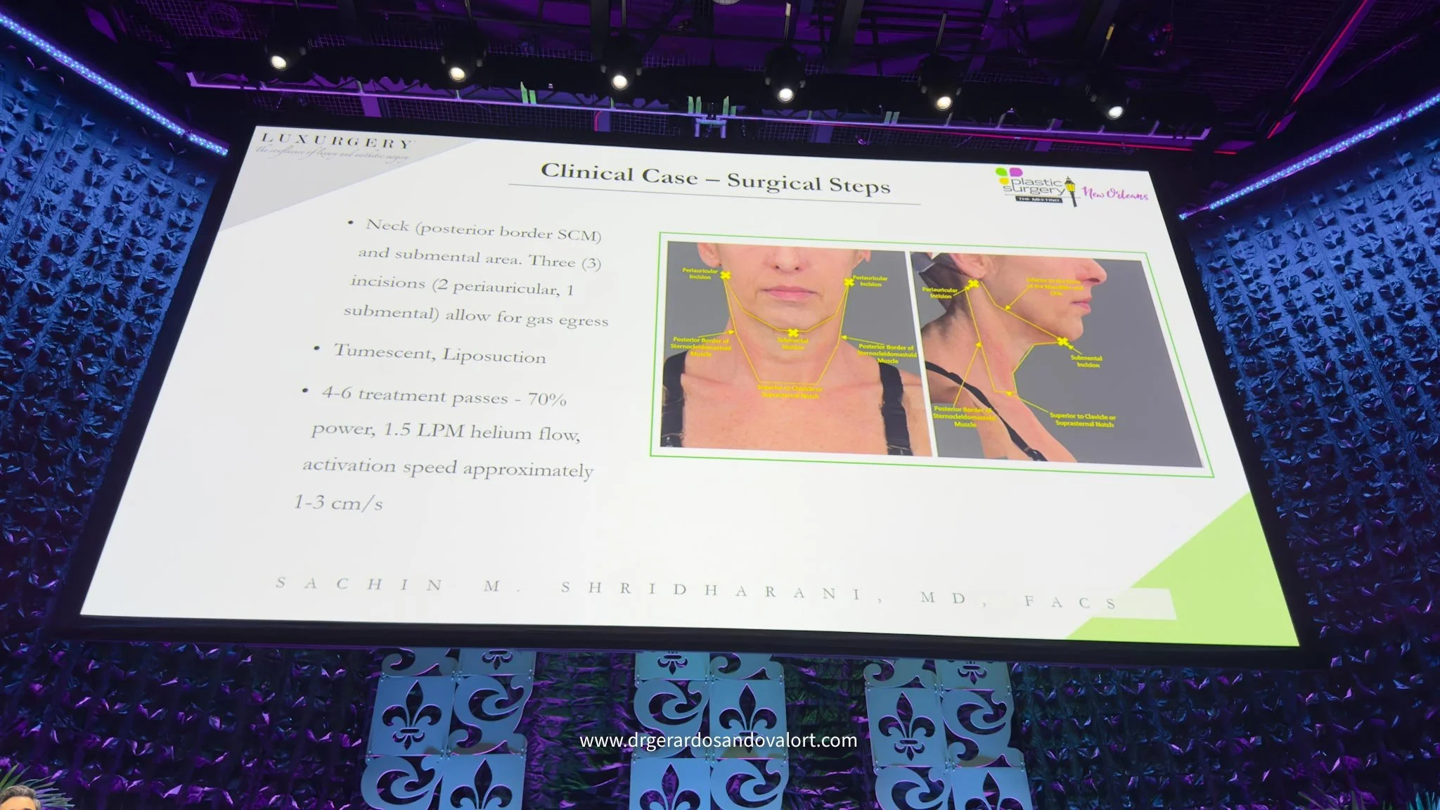 Presentación sobre el uso de Renuvion en cuello y región submentoniana durante el Plastic Surgery The Meeting 2025 en Nueva Orleans, mostrando los pasos quirúrgicos de un caso clínico