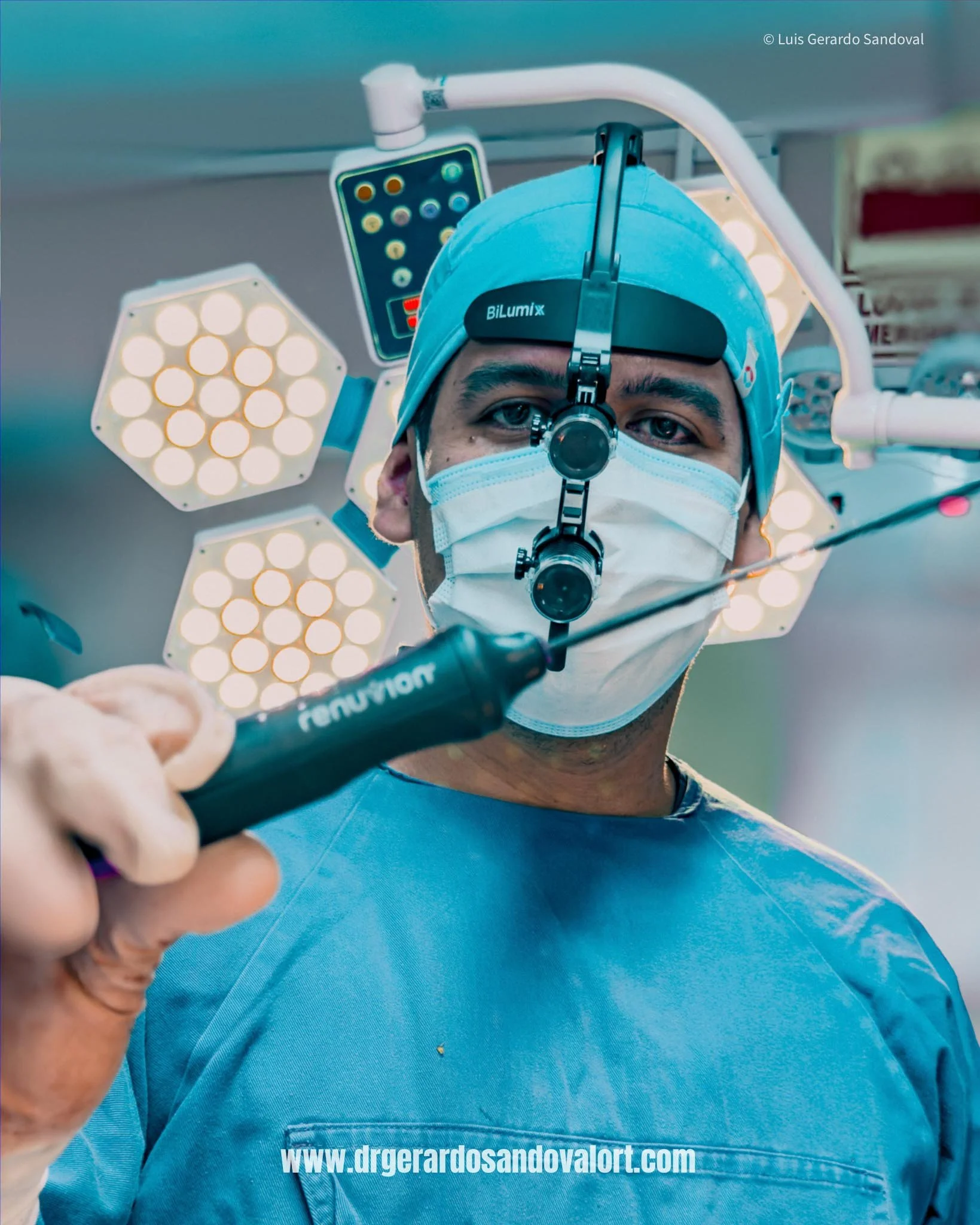 El Dr. Luis Gerardo Sandoval aplica Renuvion® en Lima durante la Liposucción 360 para tensar la piel y rejuvenecer el contorno corporal