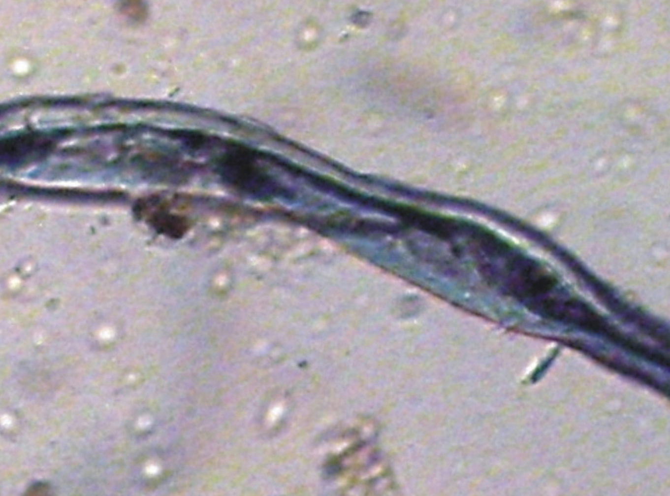 Linen fiber from the Dzudzuana Cave