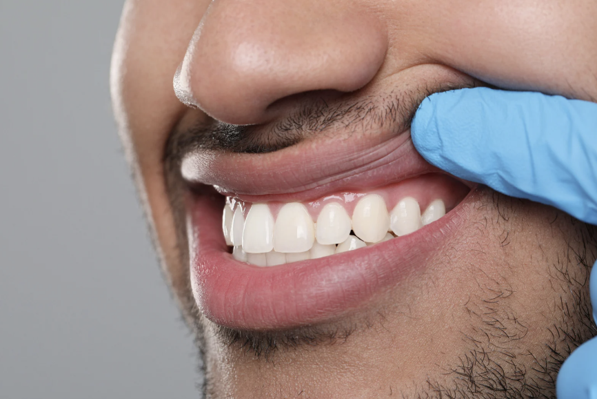How Oral Health Impacts Your Overall Health