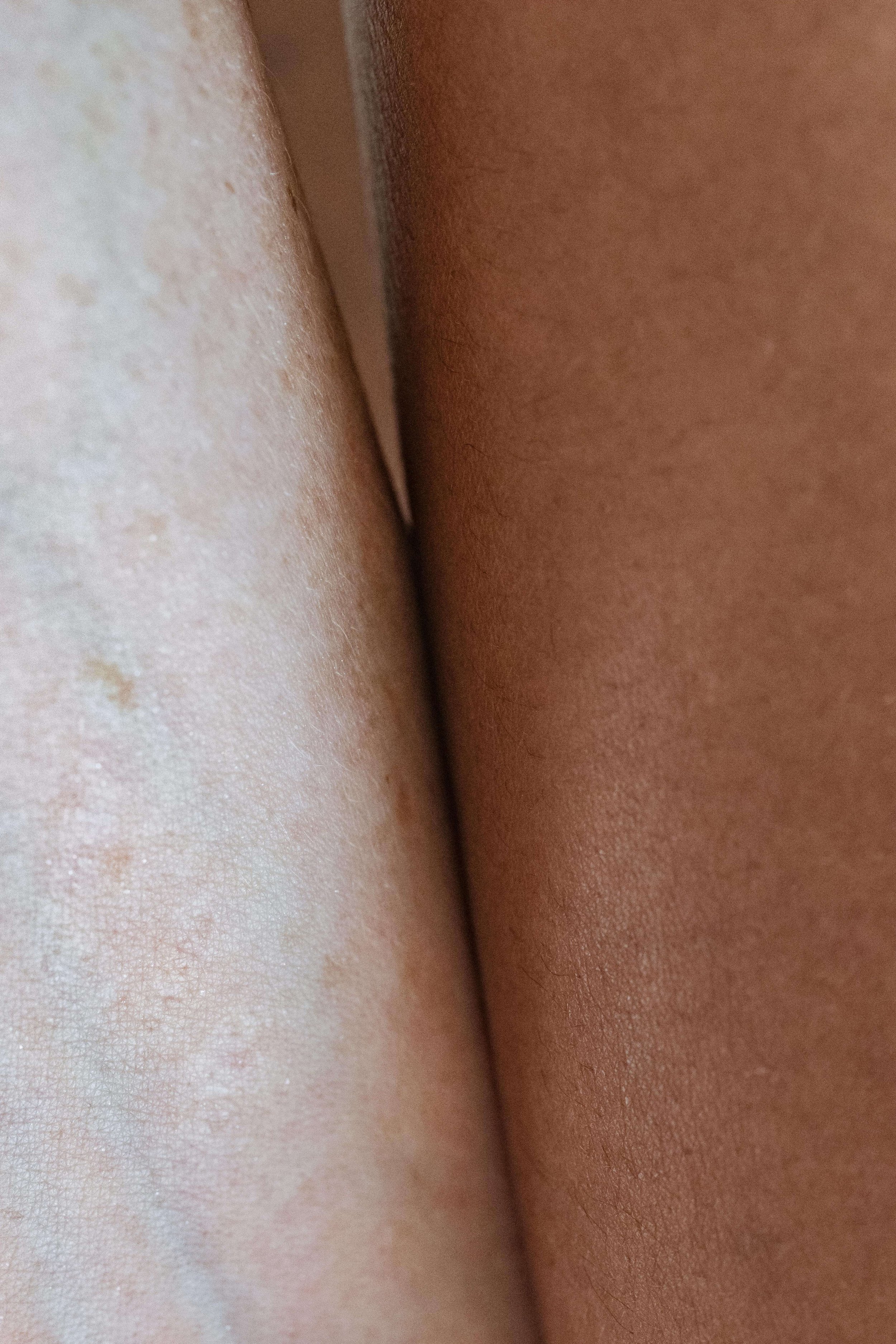 Close-up of skin textures with contrasting tones and fine hair.