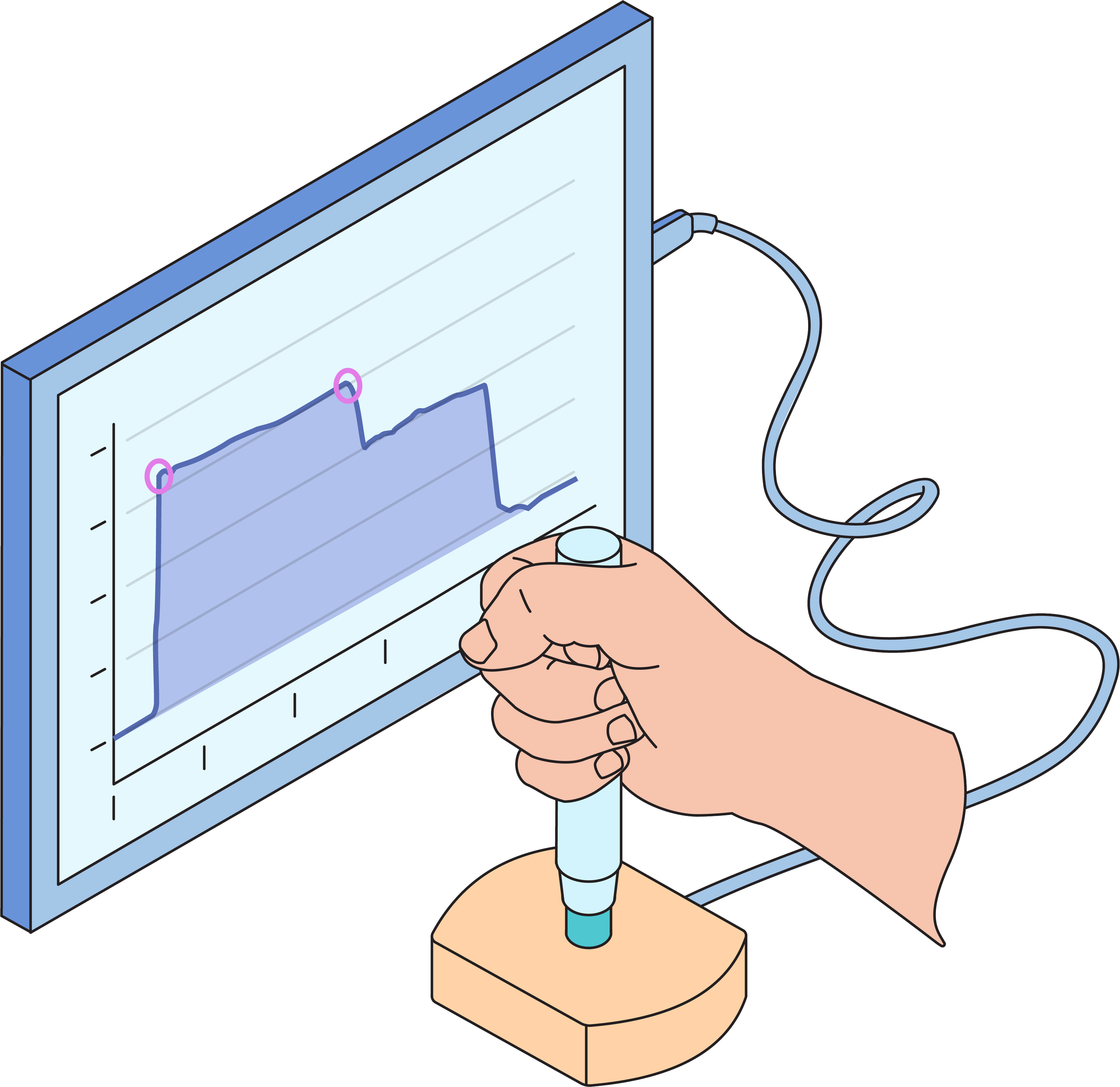 Why Injection Time Measurement Matters—and How We’re Improving It