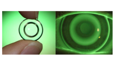 Side-by-side view of an Ortho-K lens: the left shows a rigid gas permeable corneal reshaping lens held between fingers, and the right shows the lens fitted on an eye under green fluorescein dye light, displaying a perfect concentric bullseye pattern