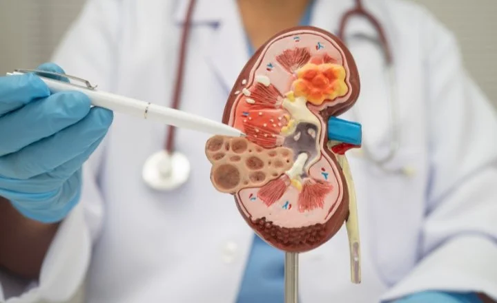 The True Cost of Uncollected Claims in Urology Practices: Revenue Leakage You Can't Afford to Ignore