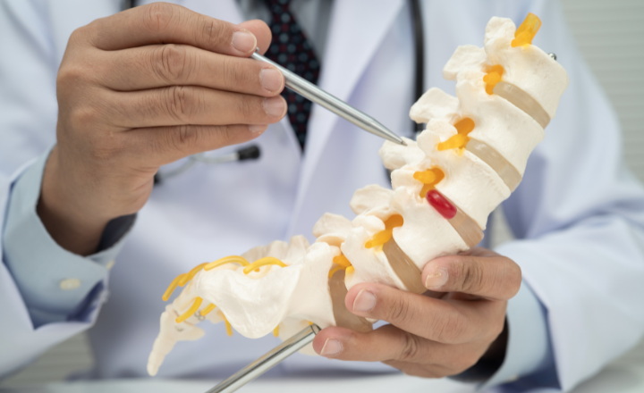 Spine Implant Revenue Leakage: From the OR Log to Final Reimbursement