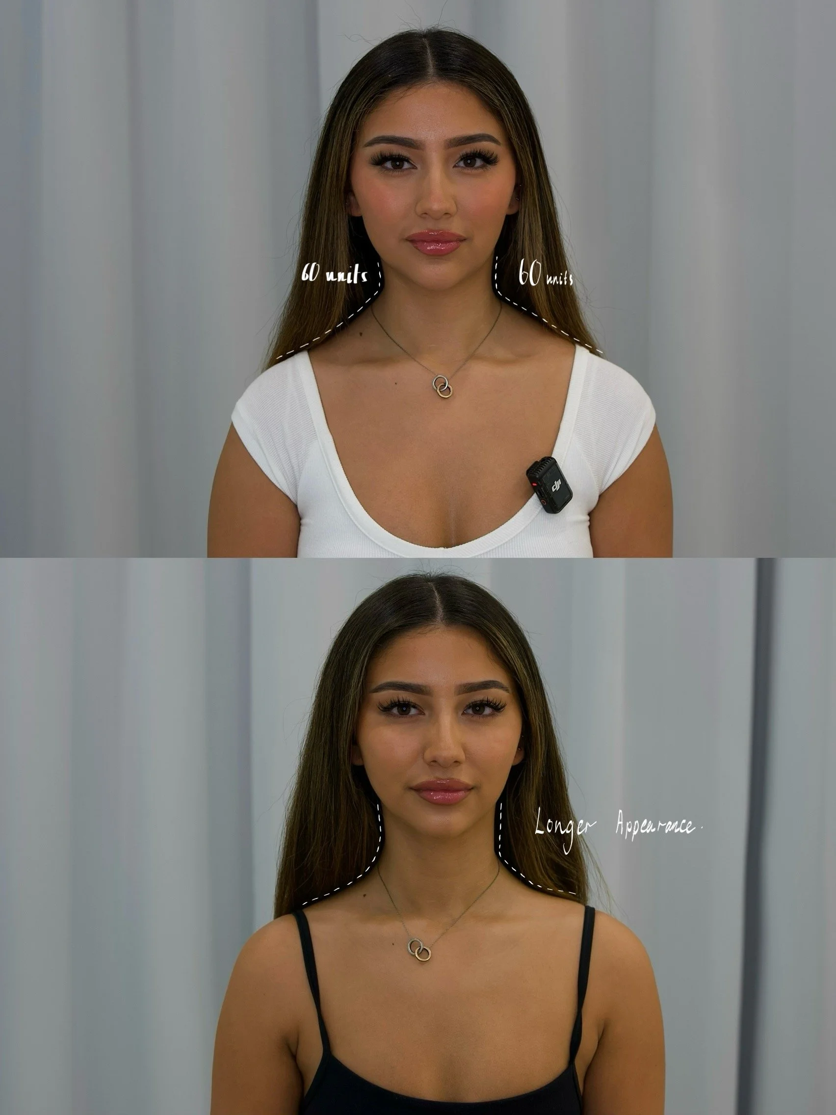 Front Before and After with markings (2).jpg