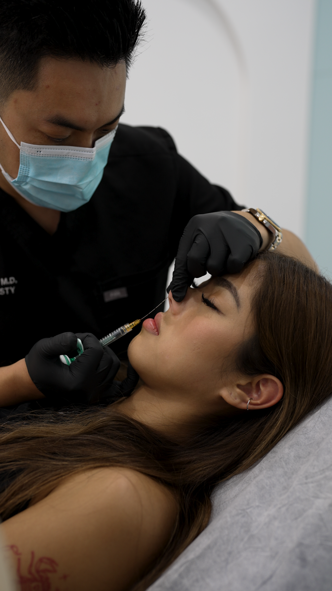 Non-Surgical Liquid Rhinoplasty for a Dorsal Hump: Does It Work?