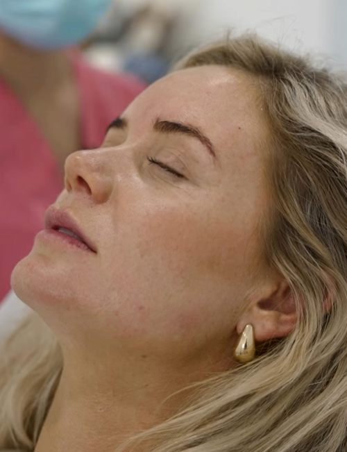 Prejuvenation: Why More People in Their 20s and 30s Are Getting Cosmetic Treatments