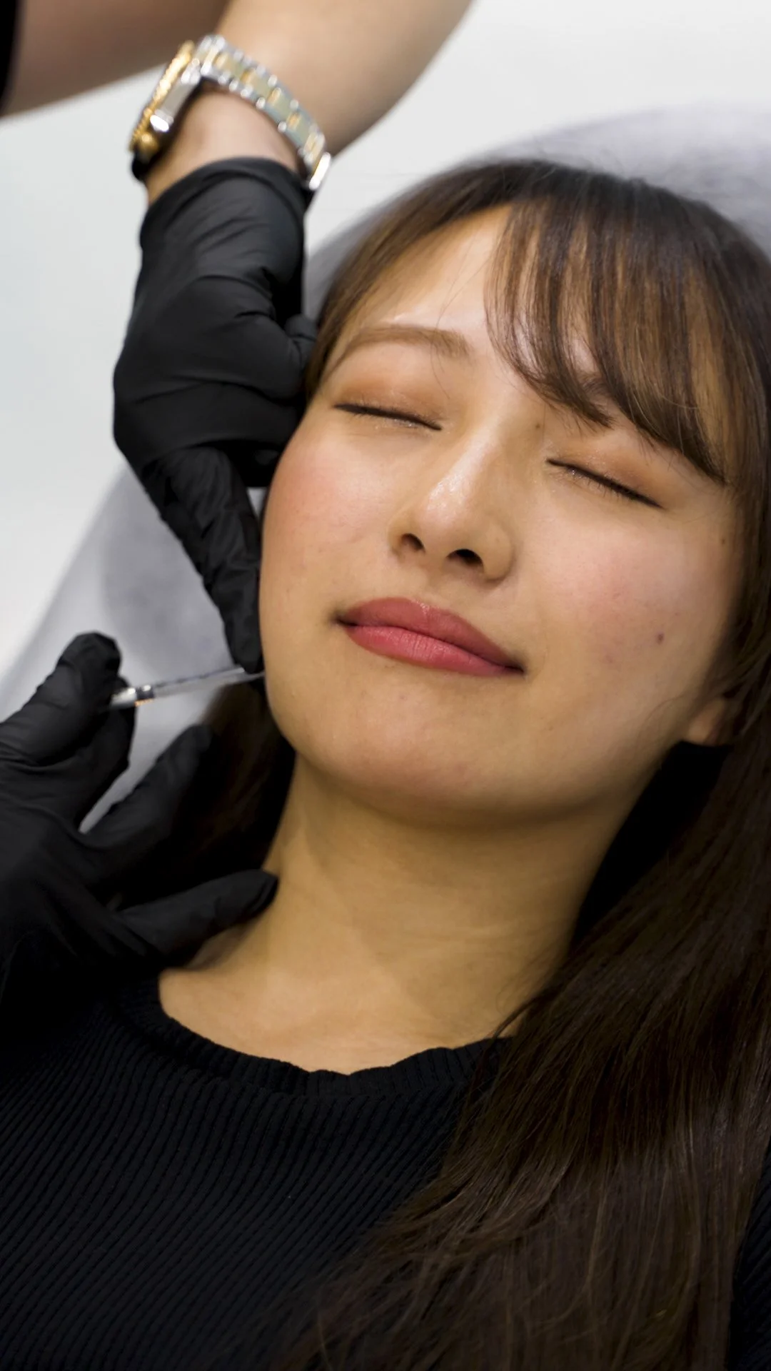 masseters procedure-32.jpg