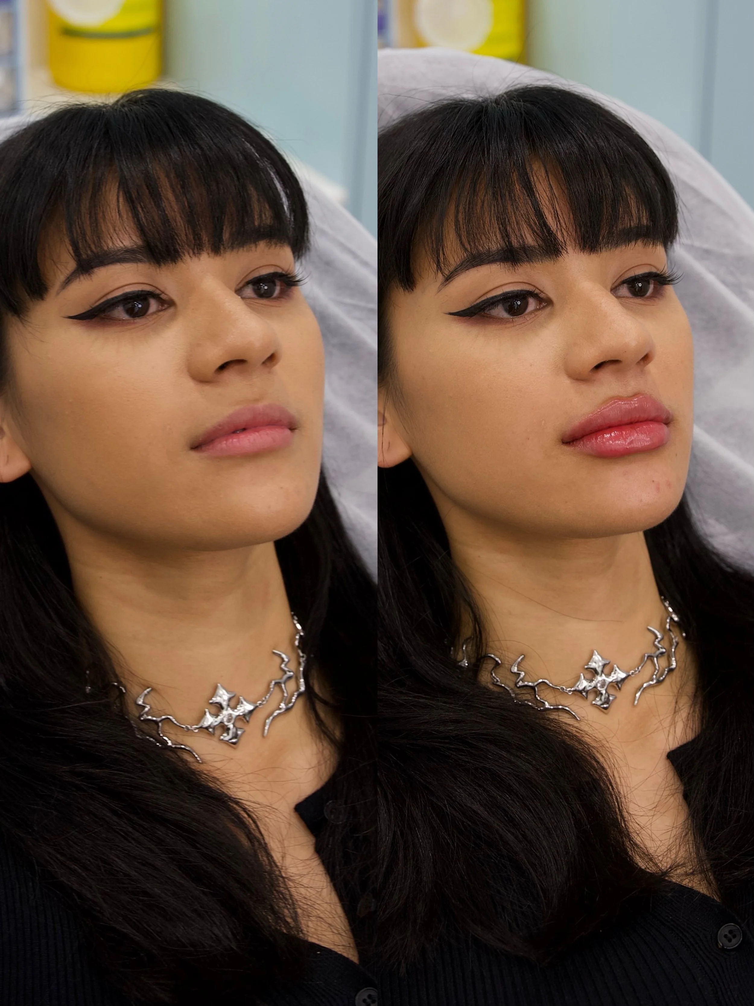 SIDE BY SIDE BA 1.jpg