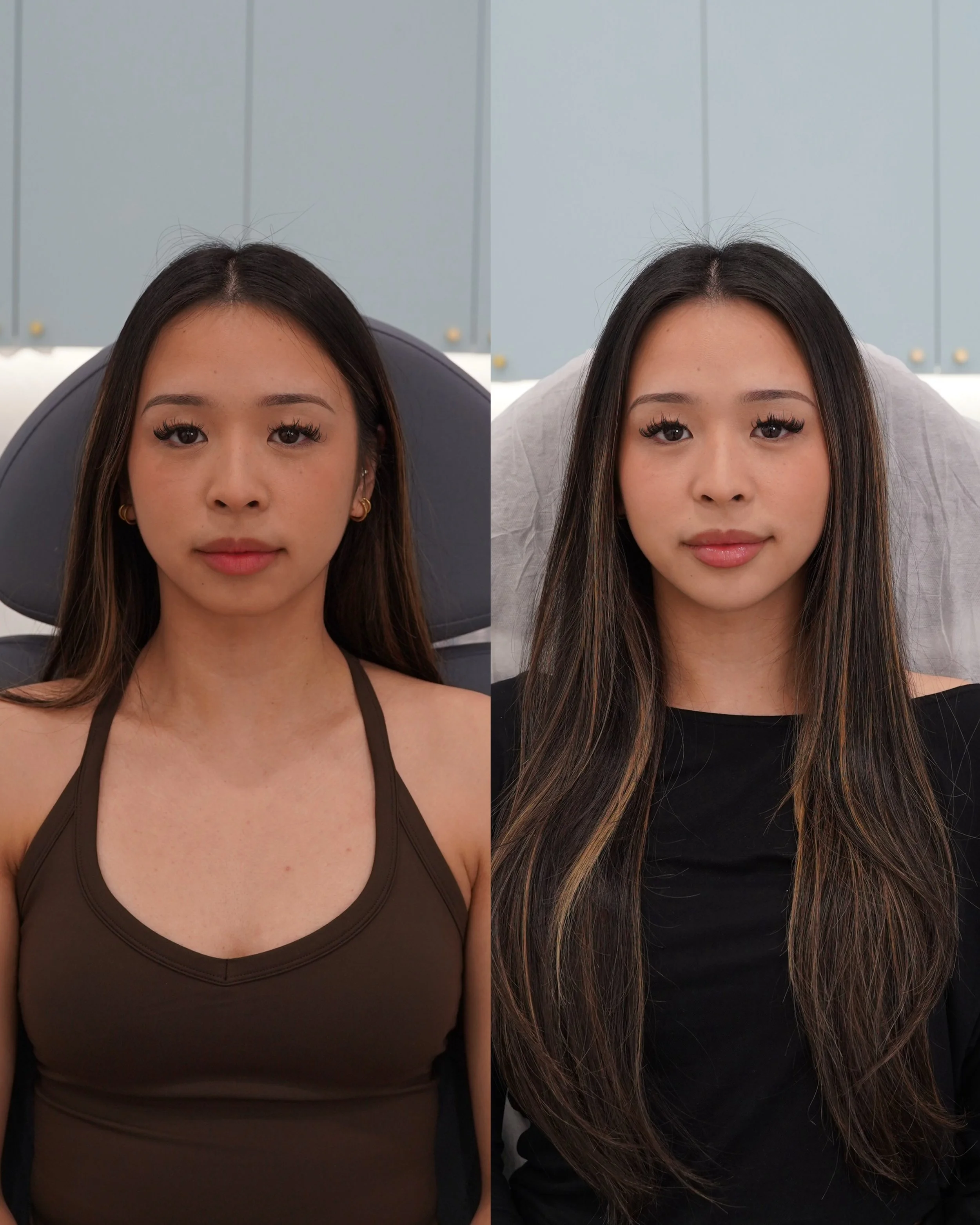 1 Tracy Chin Masseters.jpg