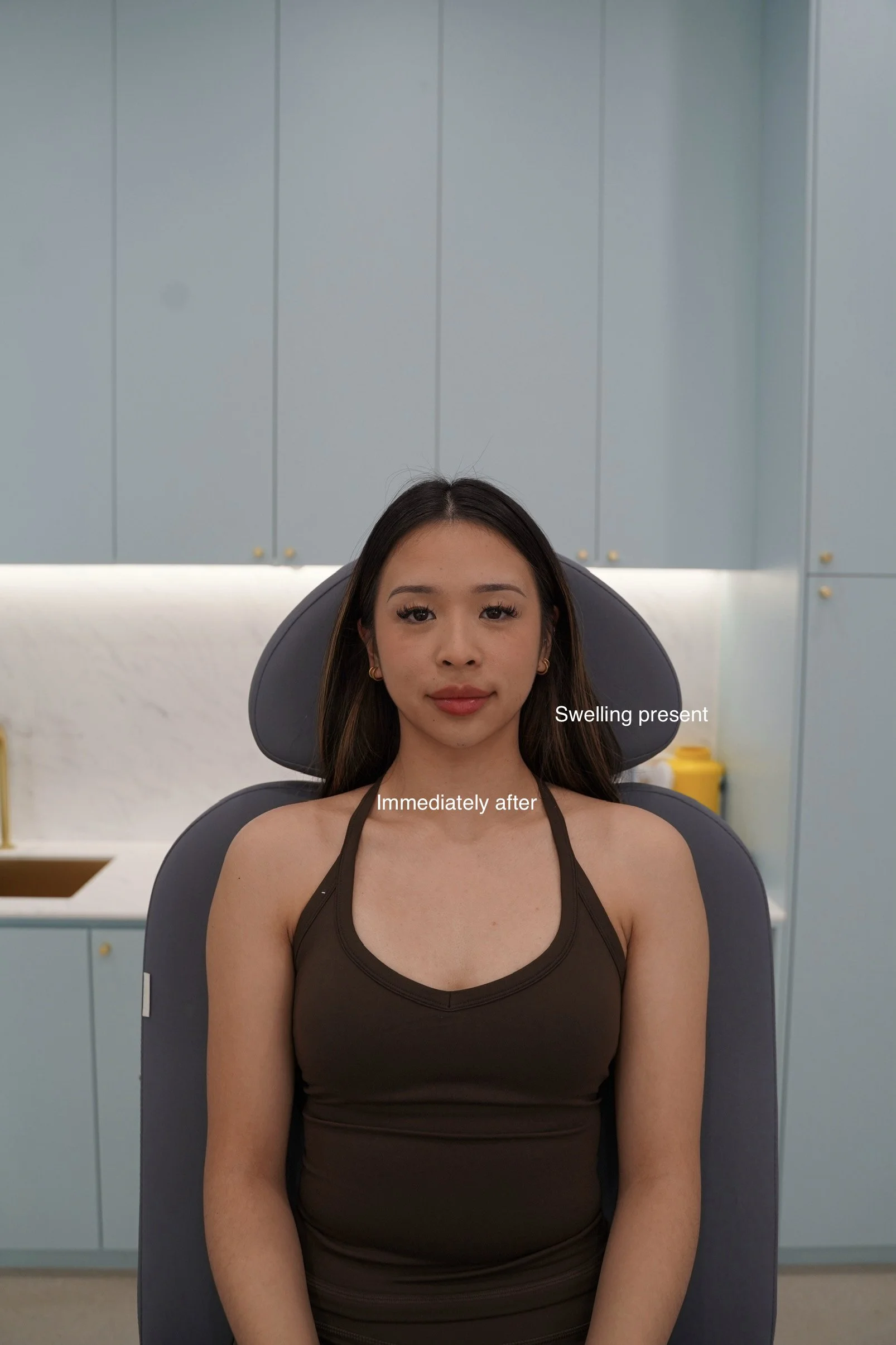 7 Tracy Chin Masseters.jpg