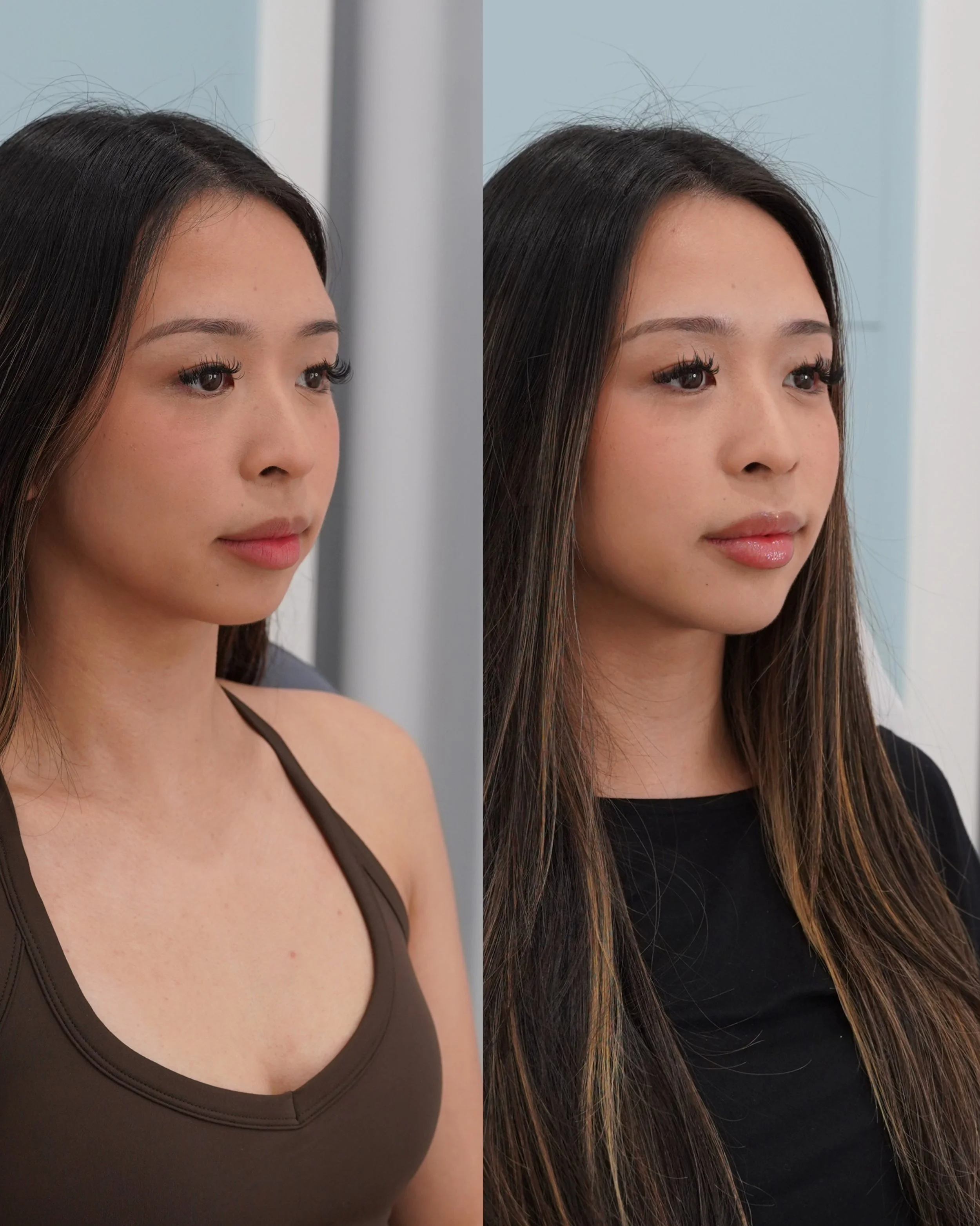 4 Tracy Chin Masseters.jpg