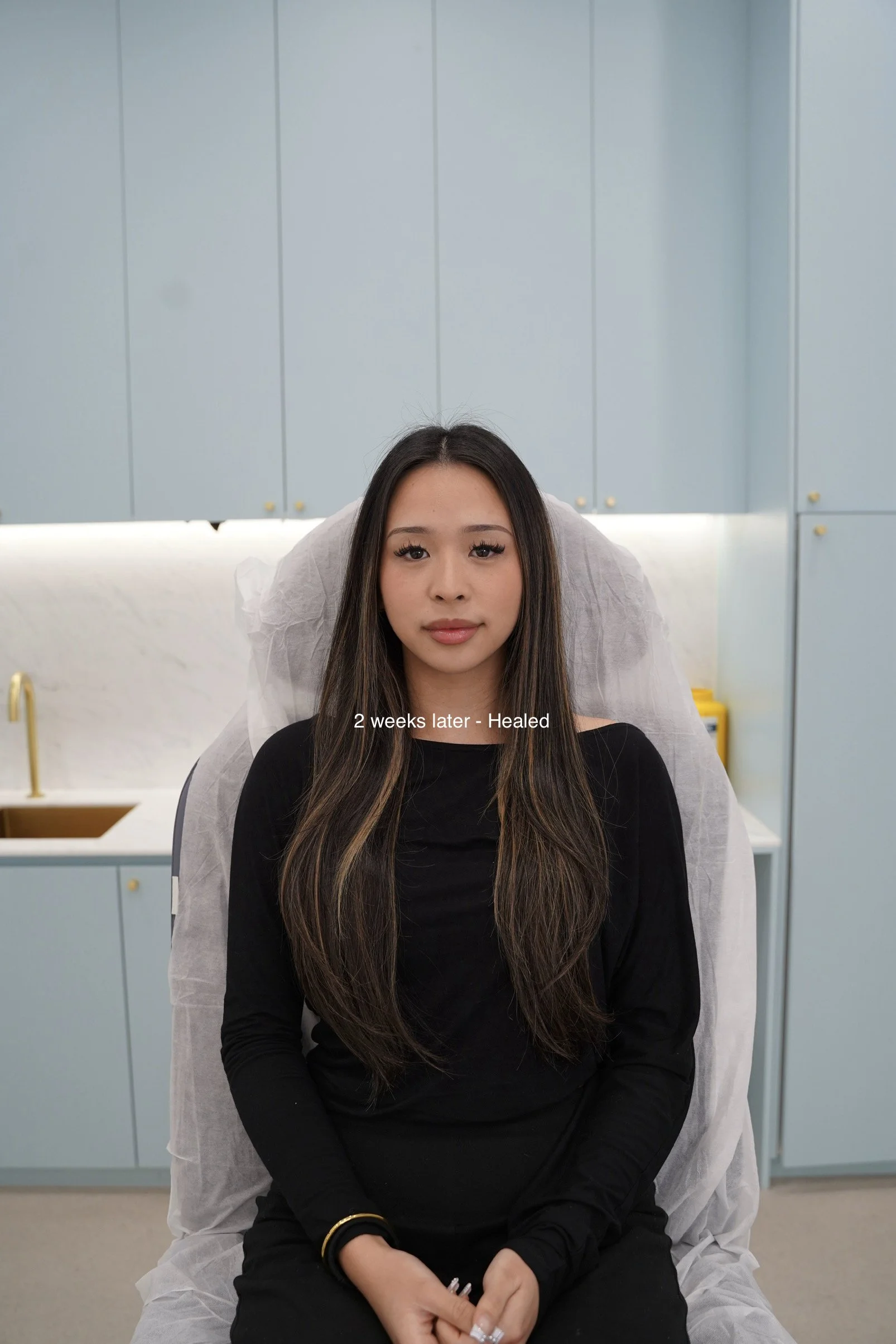 8 Tracy Chin Masseters.jpg