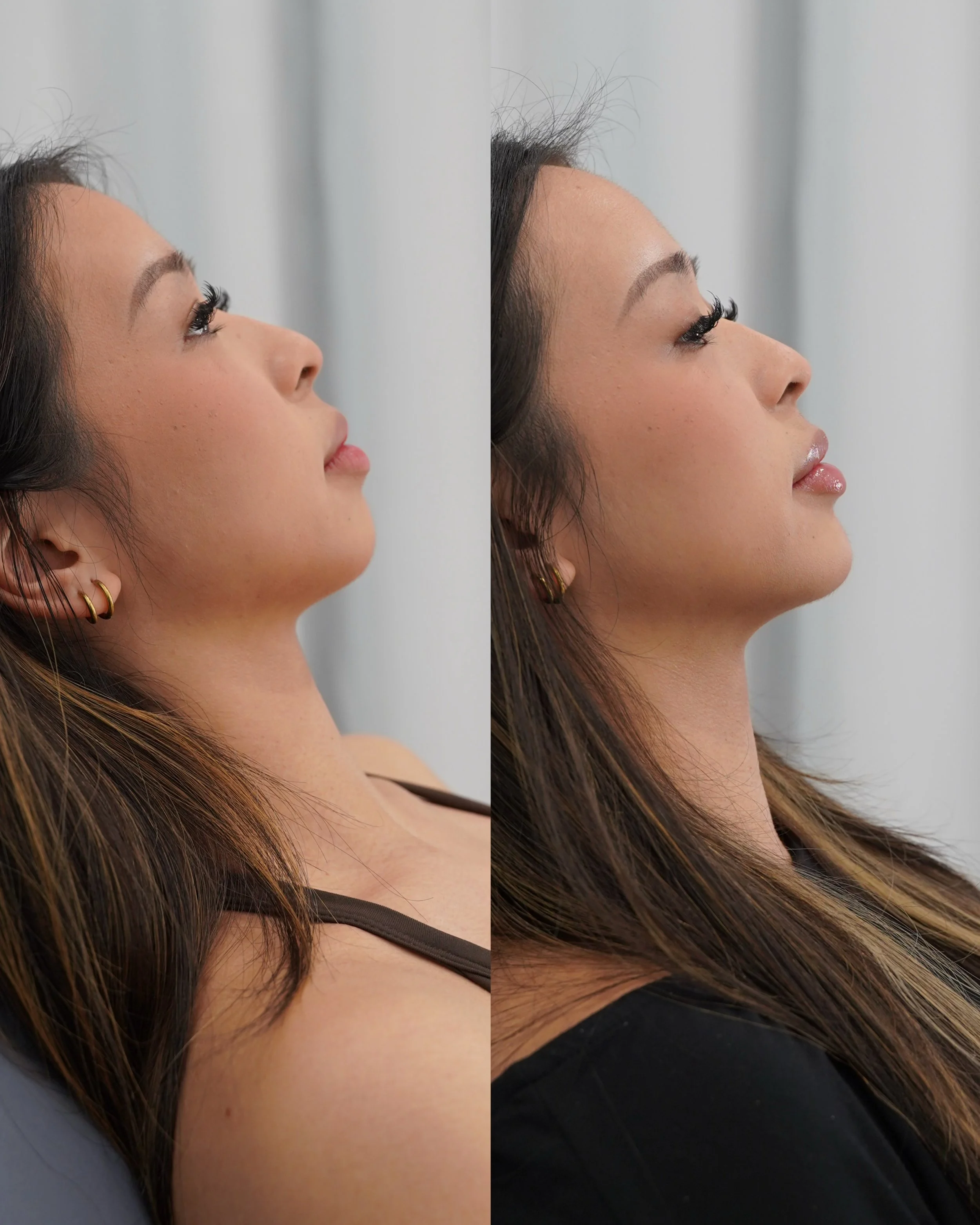 5 Tracy Chin Masseters.jpg