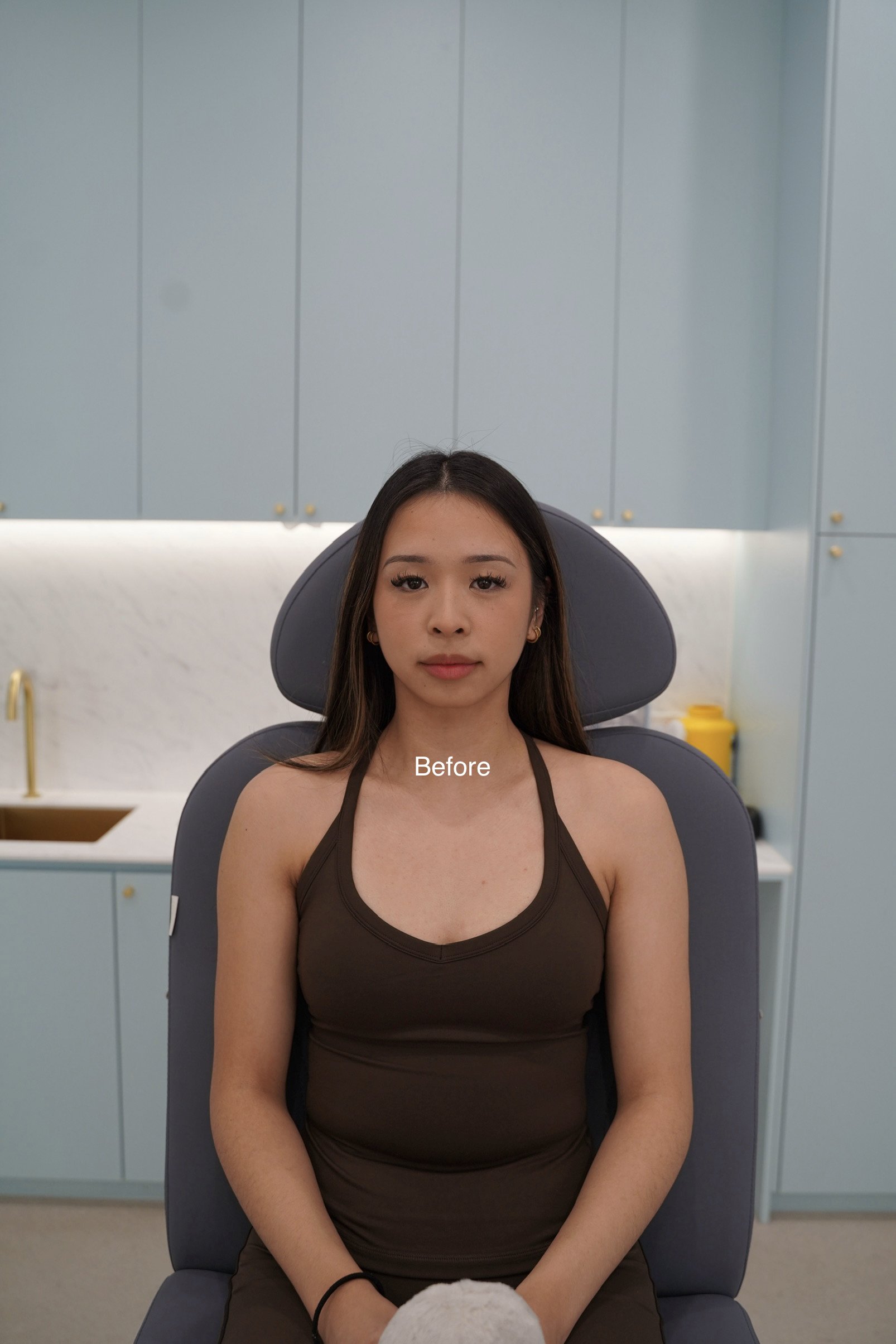 6 Tracy Chin Masseters.jpg