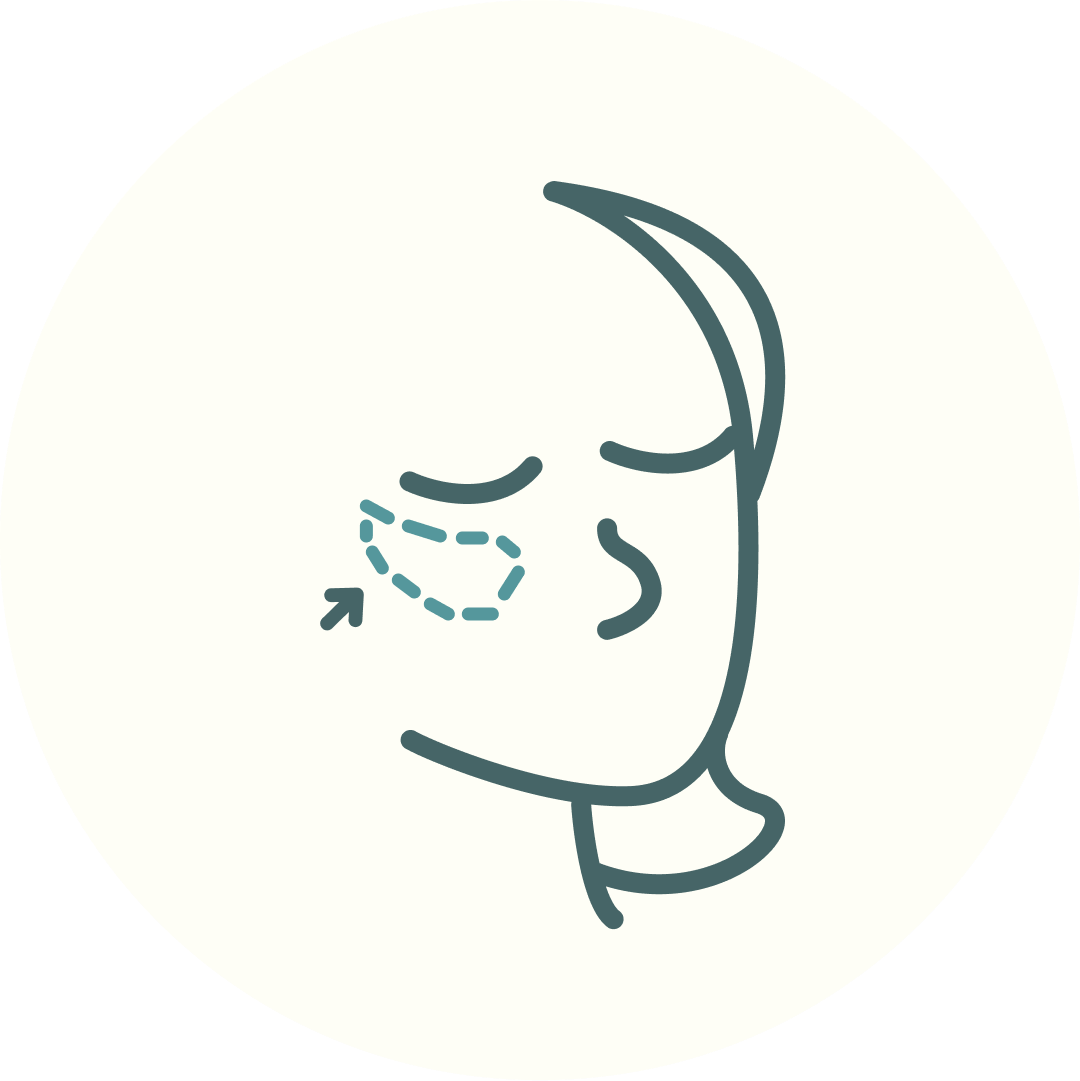 Line drawing of a face with dotted lines and an arrow under the eye, suggesting cosmetic or medical procedure.