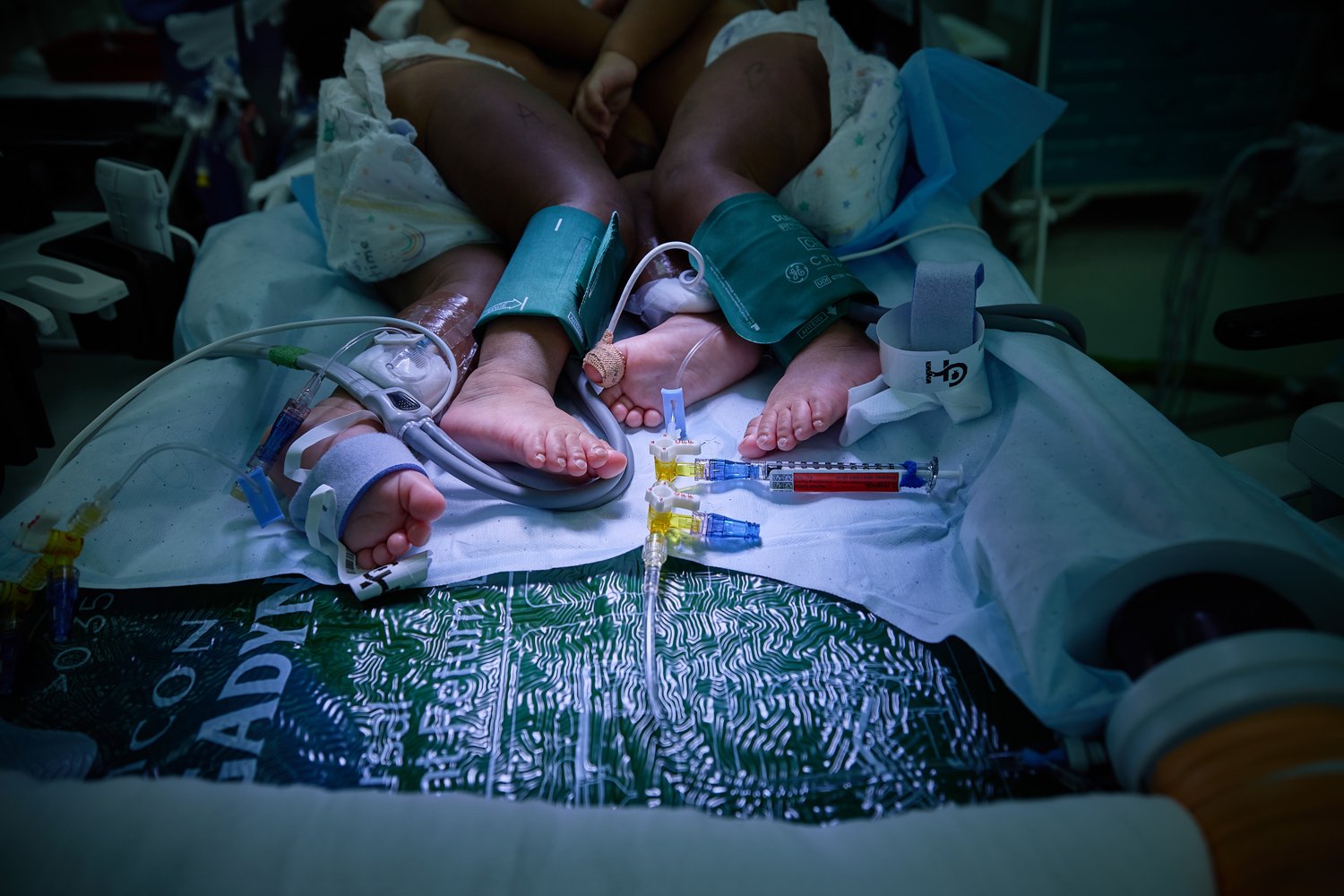 ewc-CHOPRuffinSurgery- 1106.jpg