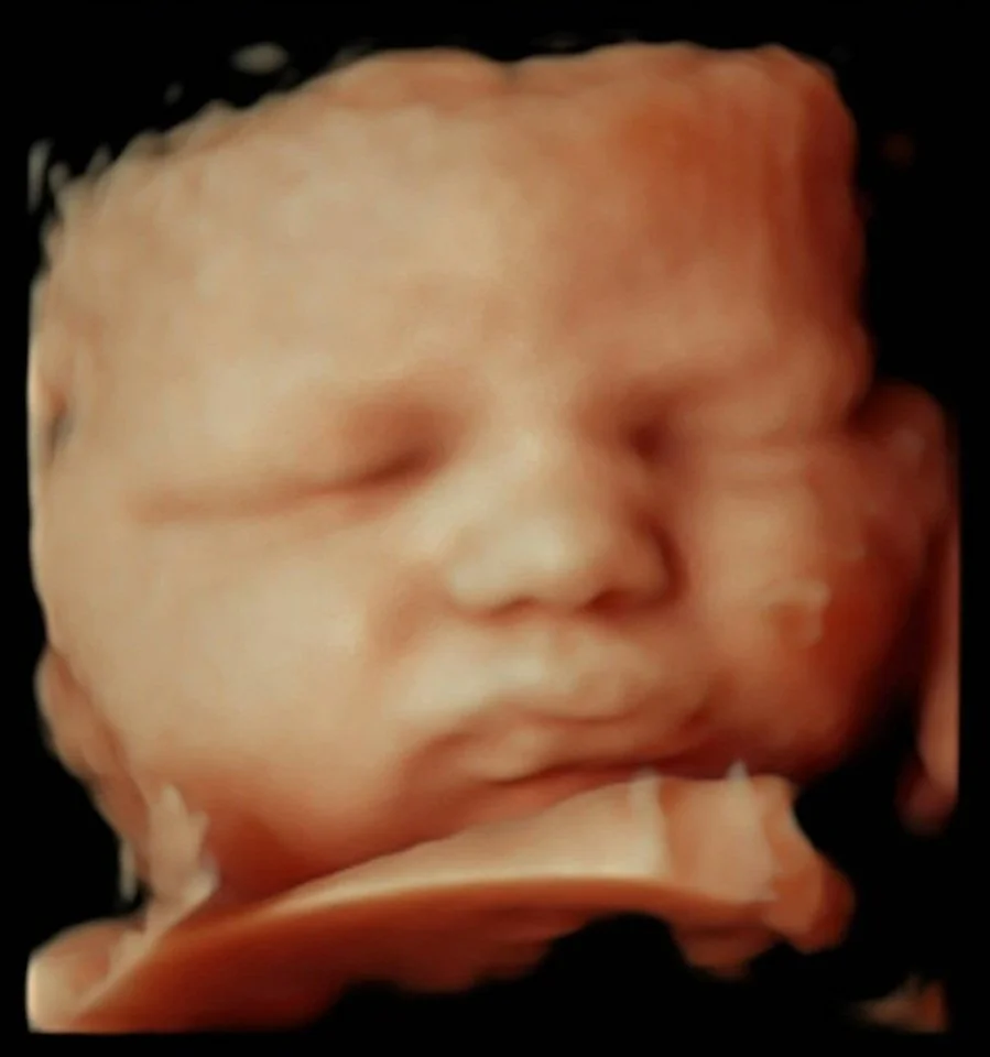 Une échographie 3D d'un bébé in utero.