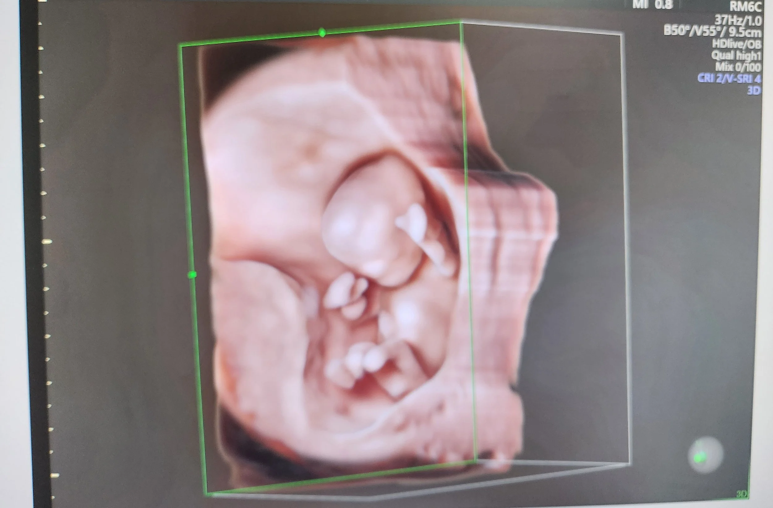Une image de scan 3D premier trimestre