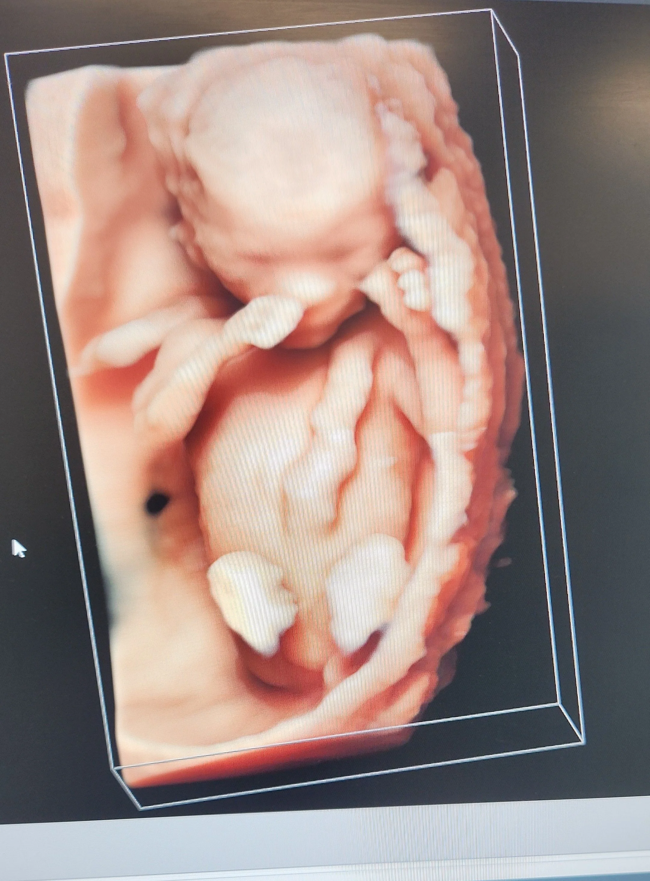 Fichier 3D d'un bébé dans l'utérus humain