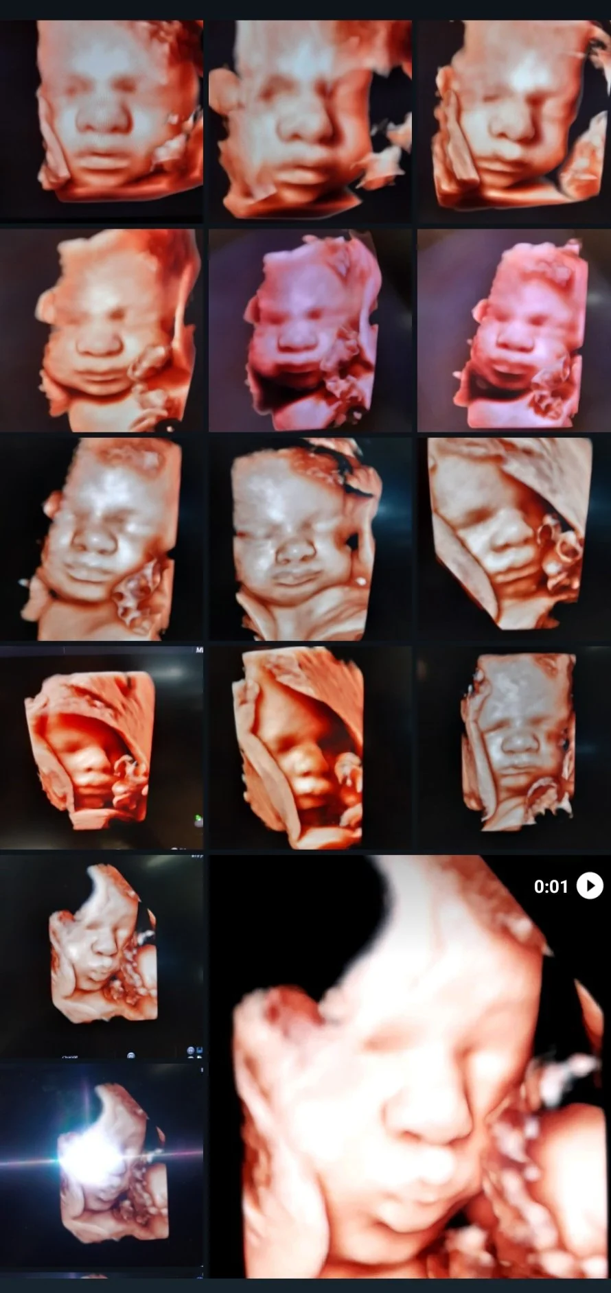 Une série d'images de 3D de visages de bébés à différentes étapes de développement, avec un gros plan sur un visage de bébé dans l'angle inférieur droit.