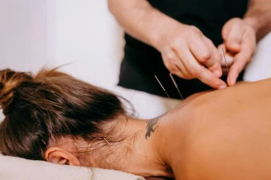 Acupuncture treatment for back pain at Serenity Acupuncture & Wellness in Coeur d'Alene Idaho