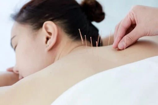 Acupuncture treatment for back pain at acupuncture clinic in Coeur d'Alene Idaho
