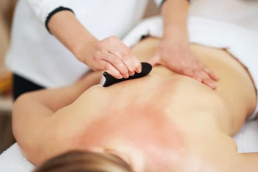 Gua sha therapy used in Chinese medicine at acupuncture clinic in Coeur d'Alene Idaho