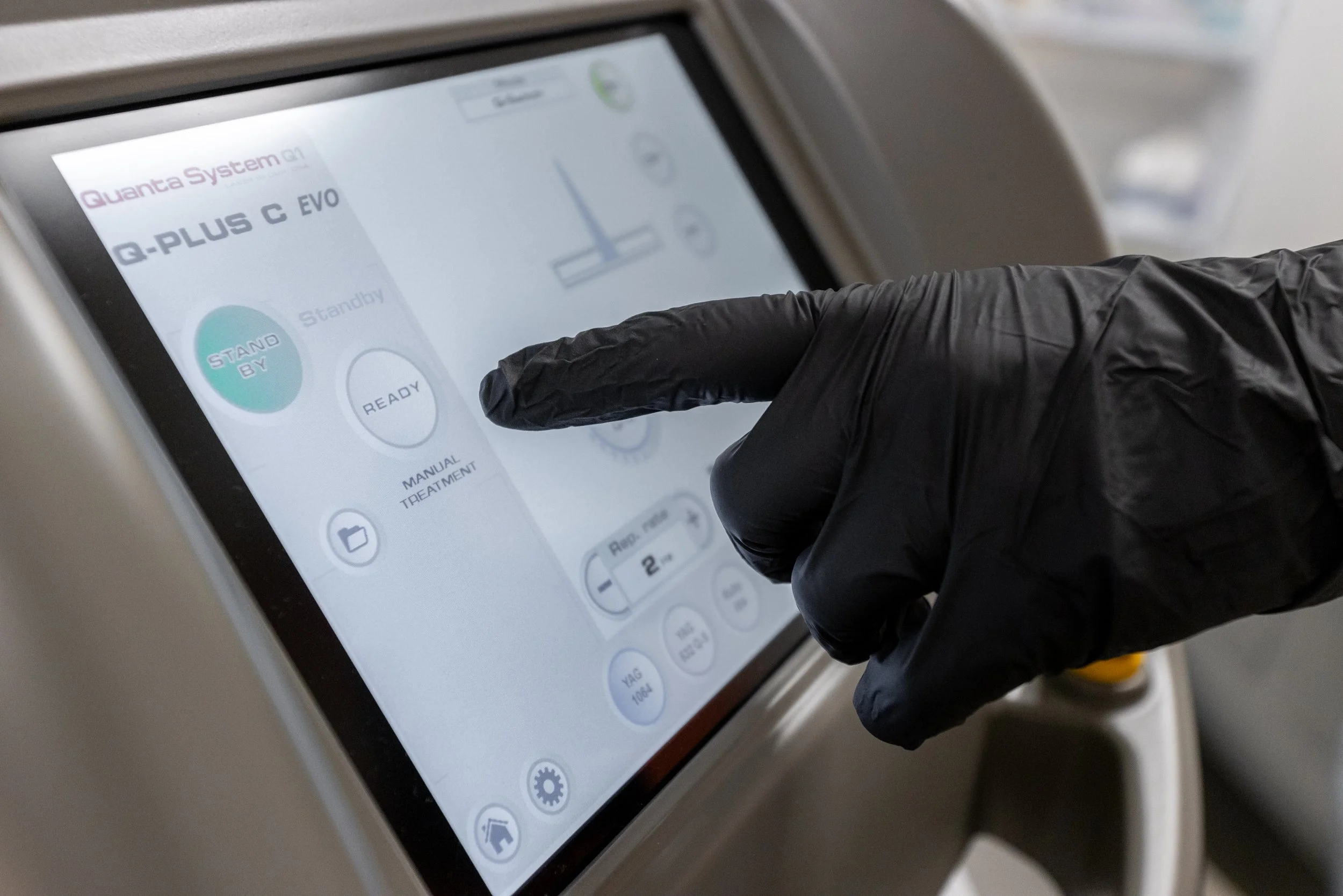 Instellen van de Quanta System laser voor een behandeling voor tatoeage verwijderen