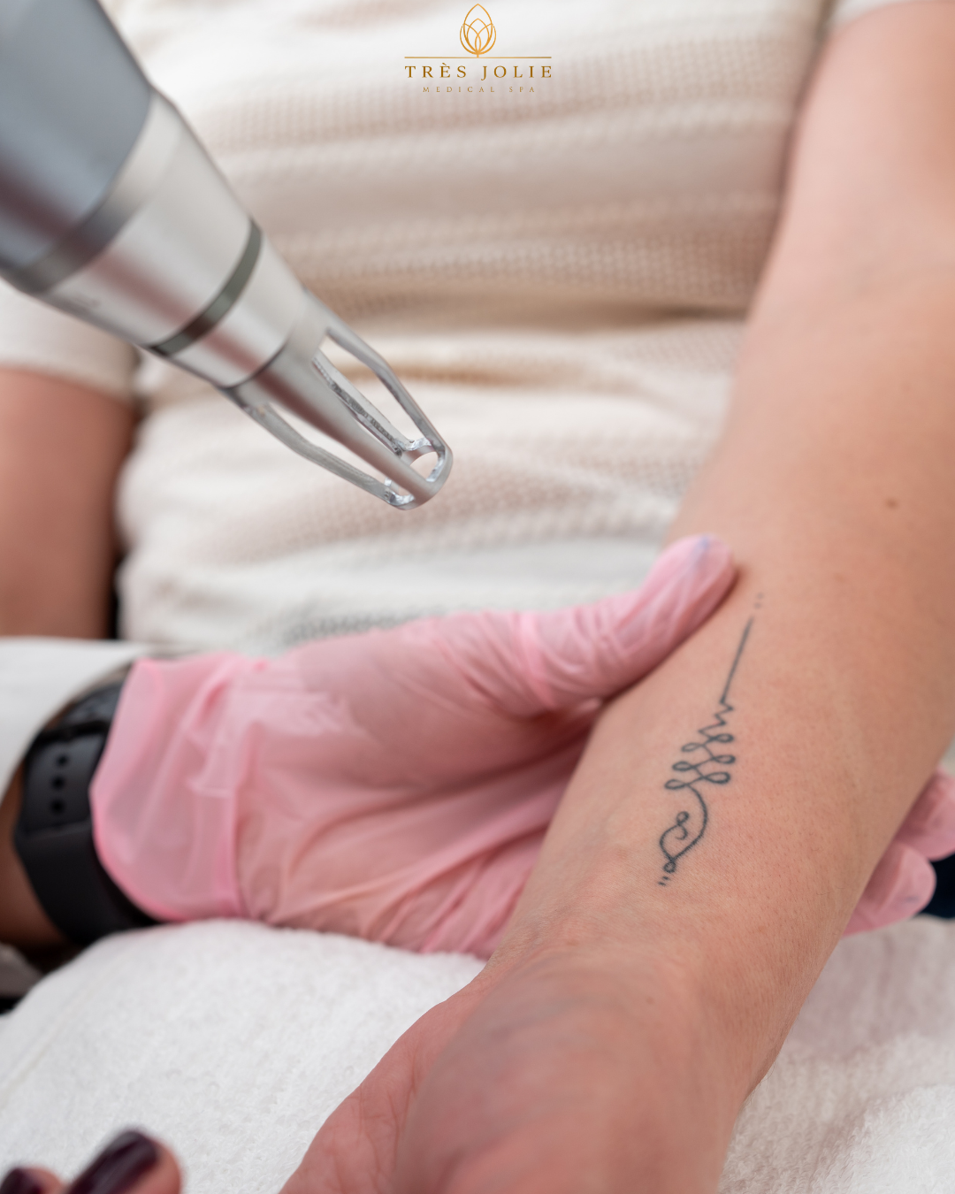 PicoFY tattoo removal now availbe for booking in chicago