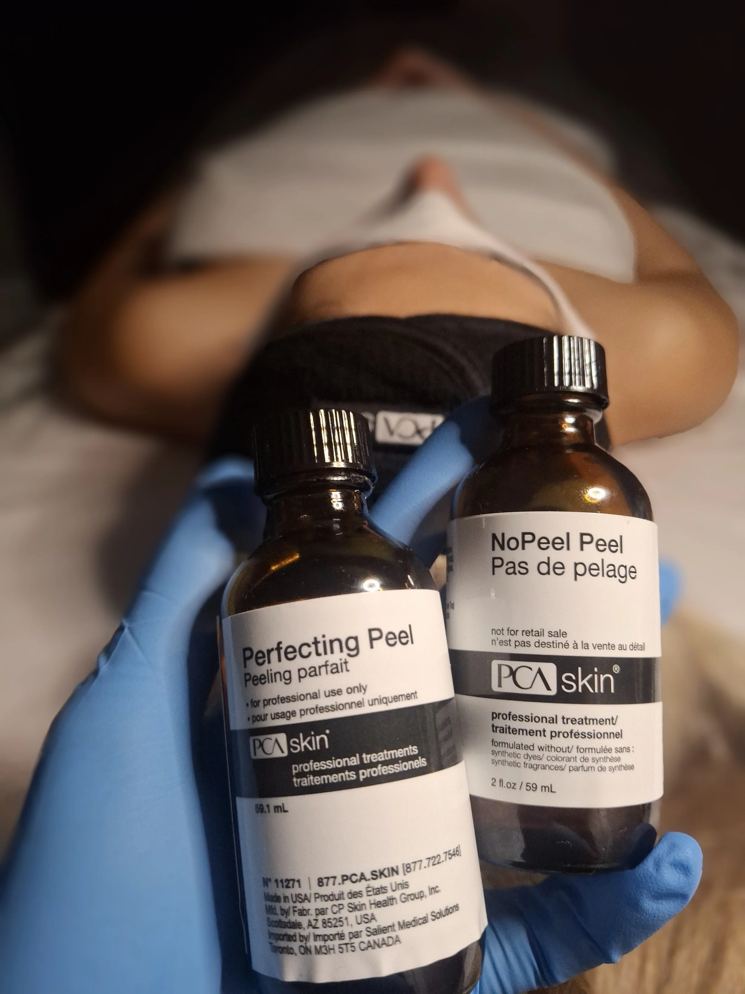 A person wearing a face mask and a black shirt lying down on a table, holding two small bottles of PCA skin treatment products in blue-gloved hands, with another person’s legs visible in the background.
